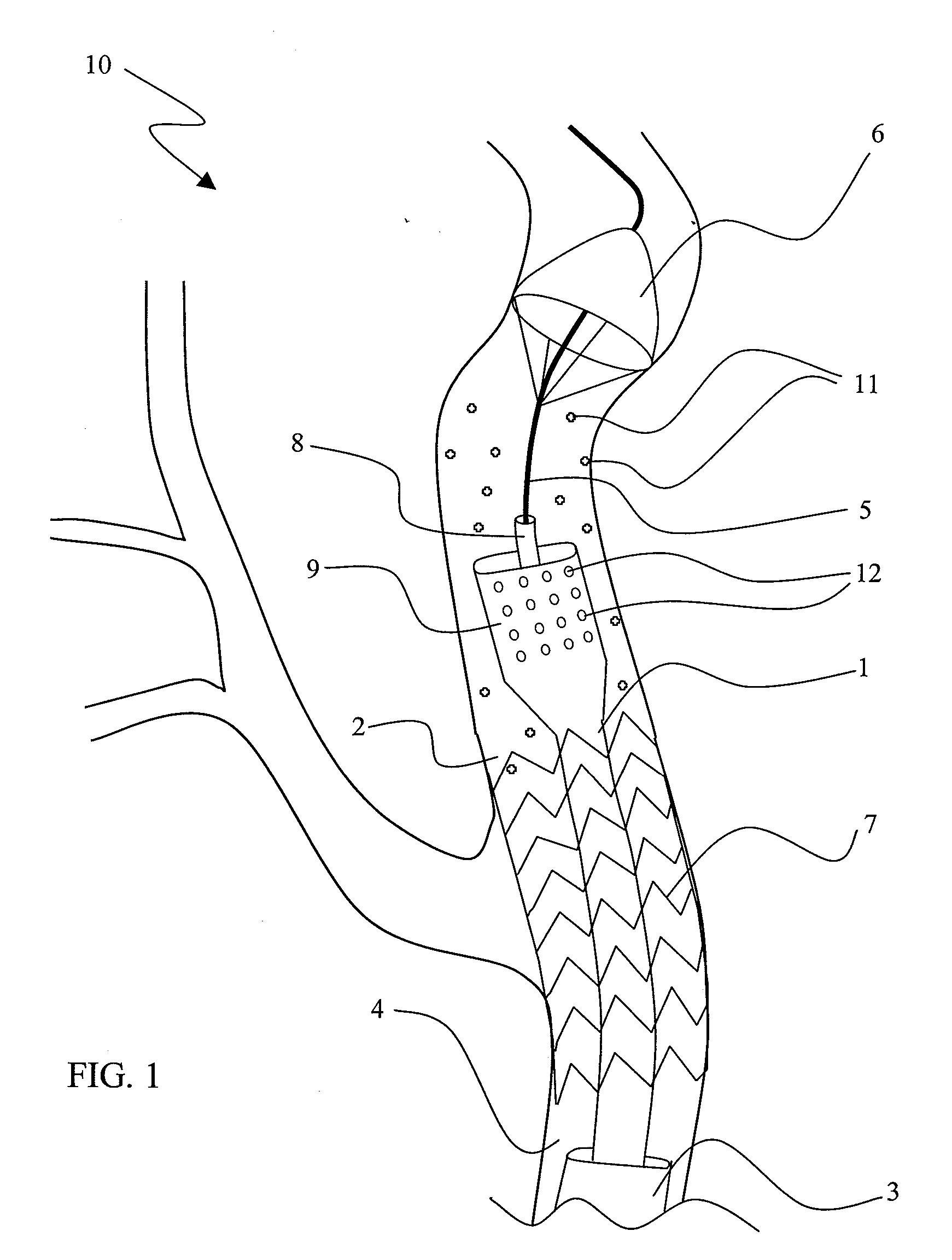 Vascular catheter with aspiration capabilities and expanded distal tip