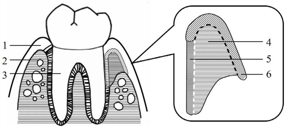 Preparation method of regional function specific clinical periodontal defect repair module