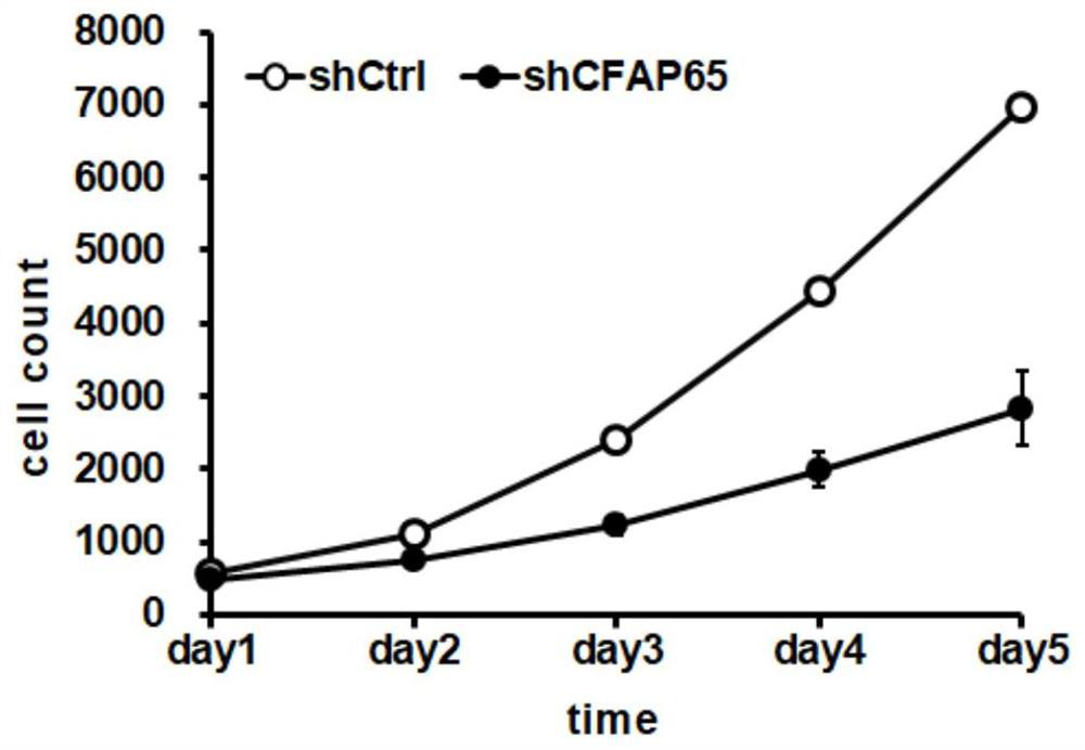 Application of human CFAP65 gene and related products