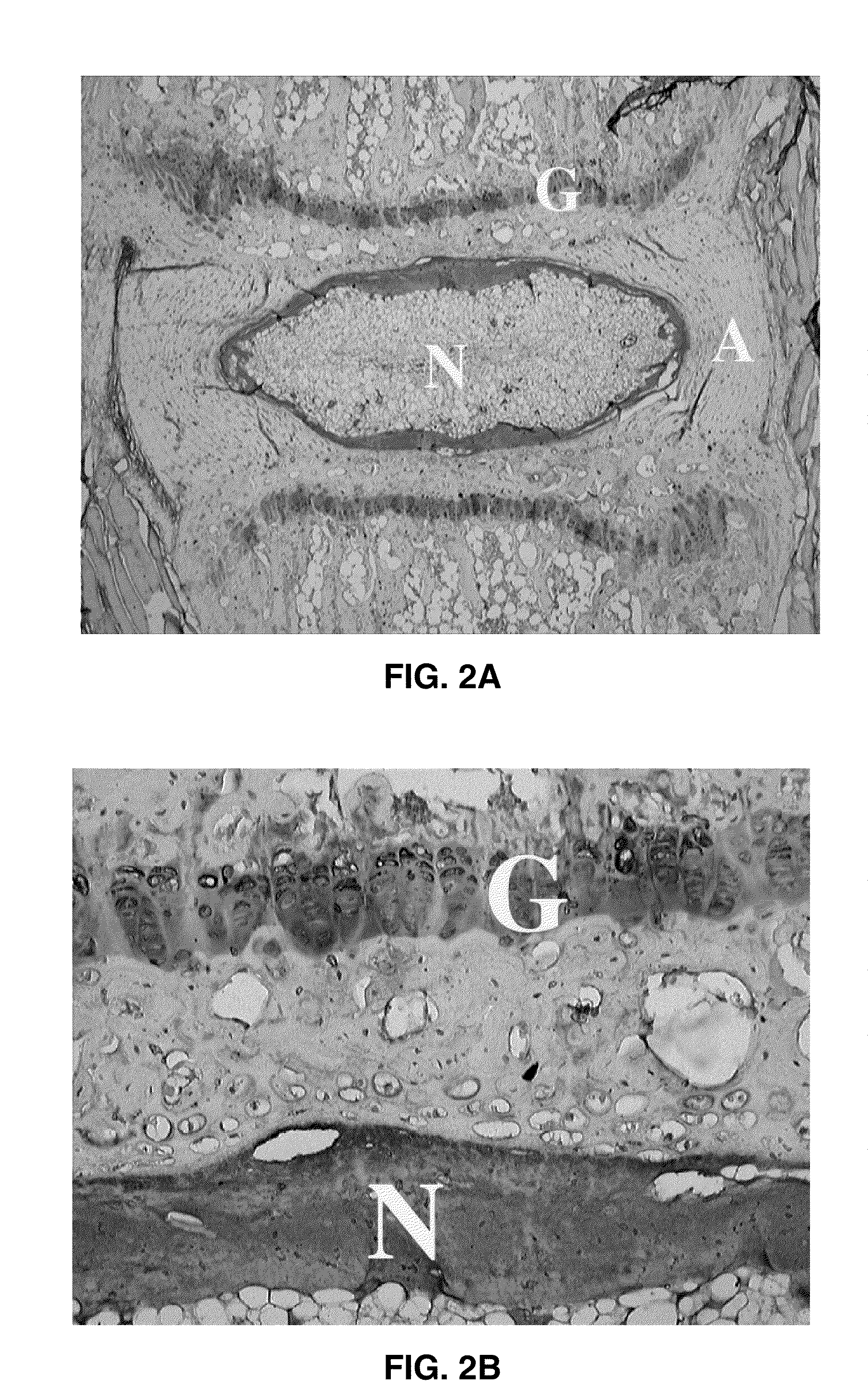 Systems, compositions, and methods for local imaging and treatment of pain