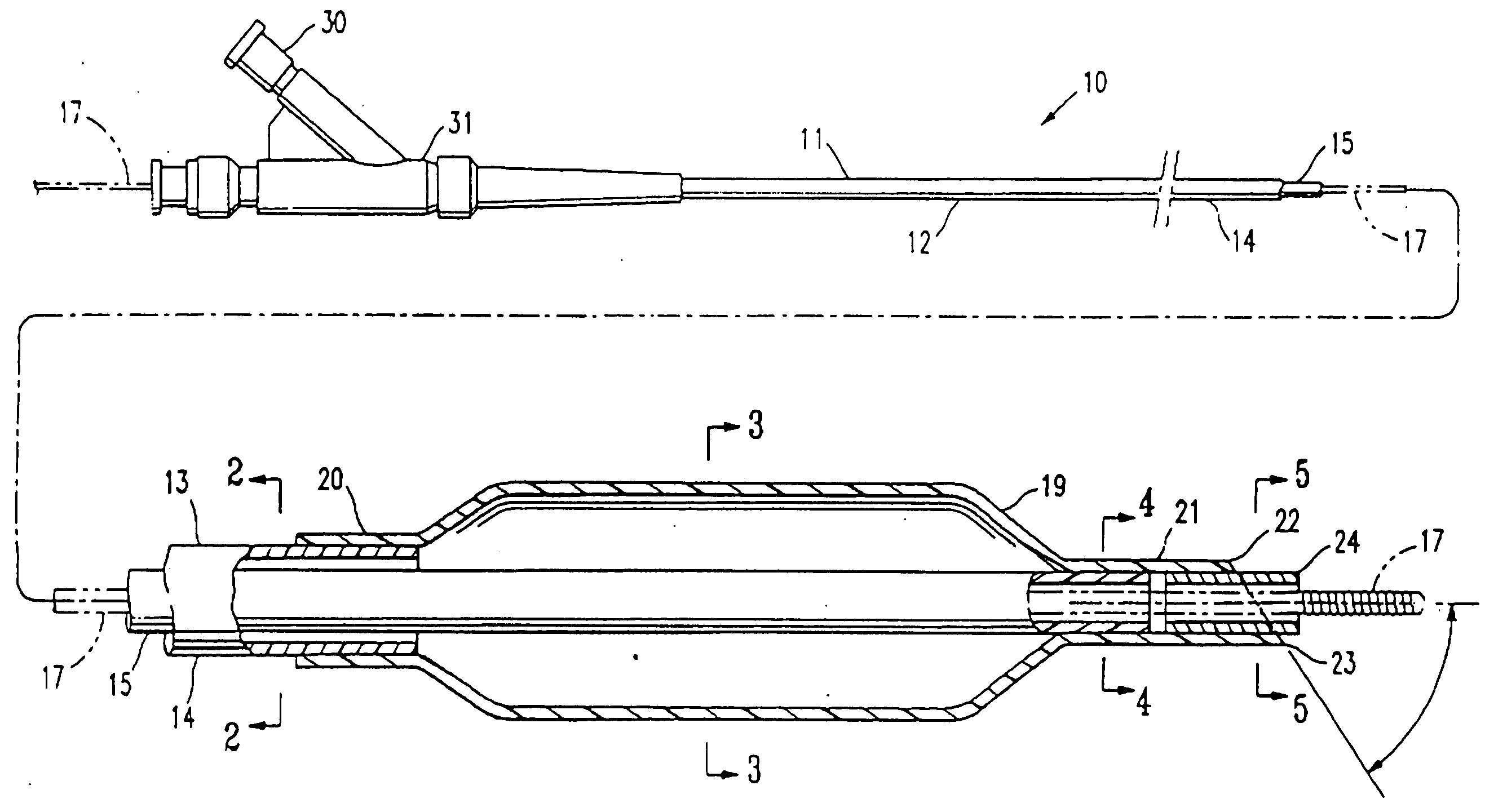 Balloon catheter having a flexible distal end