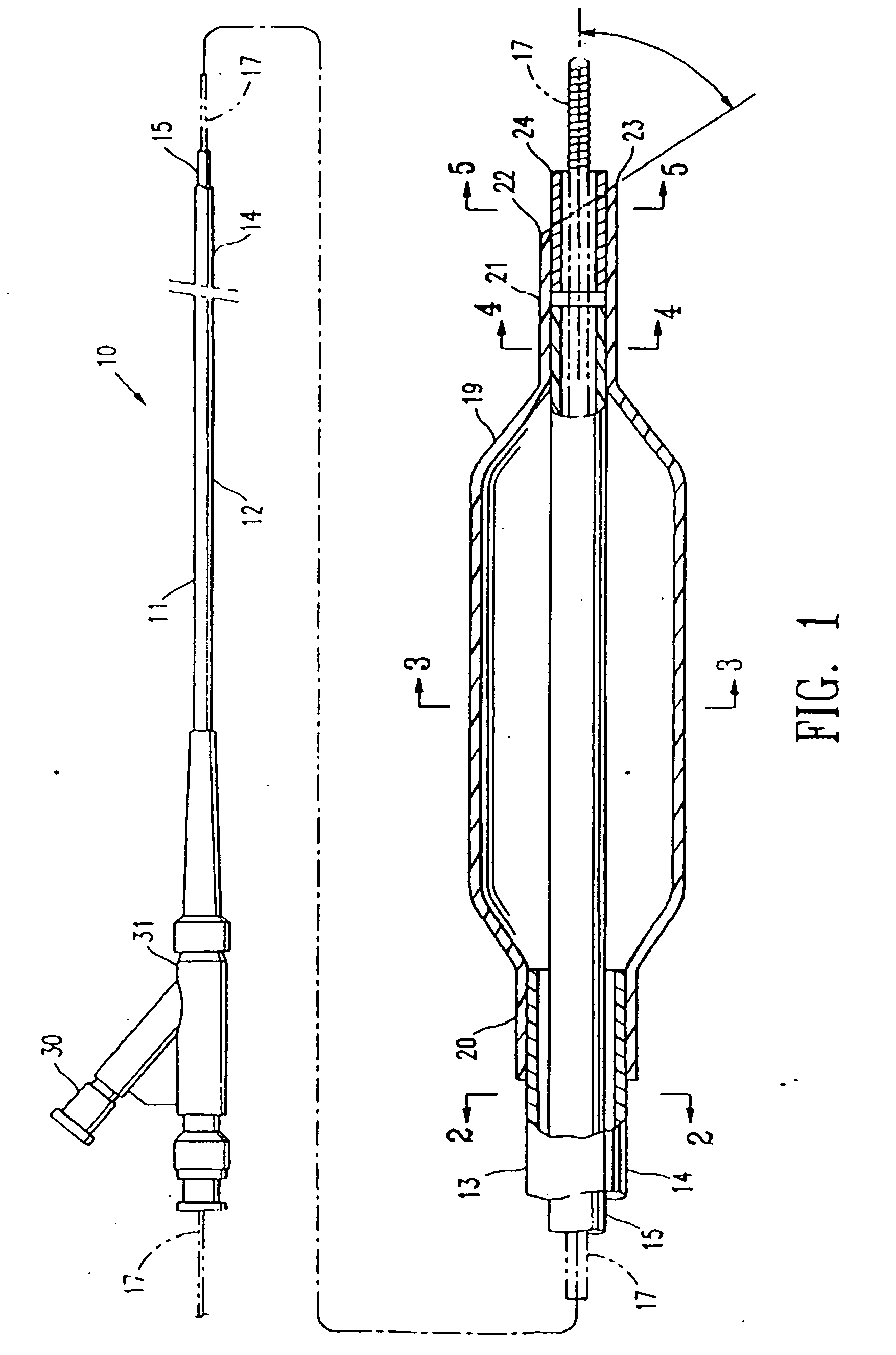 Balloon catheter having a flexible distal end