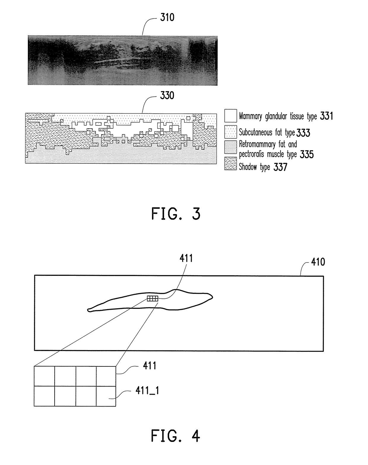 Medical image processing apparatus and breast image processing method thereof