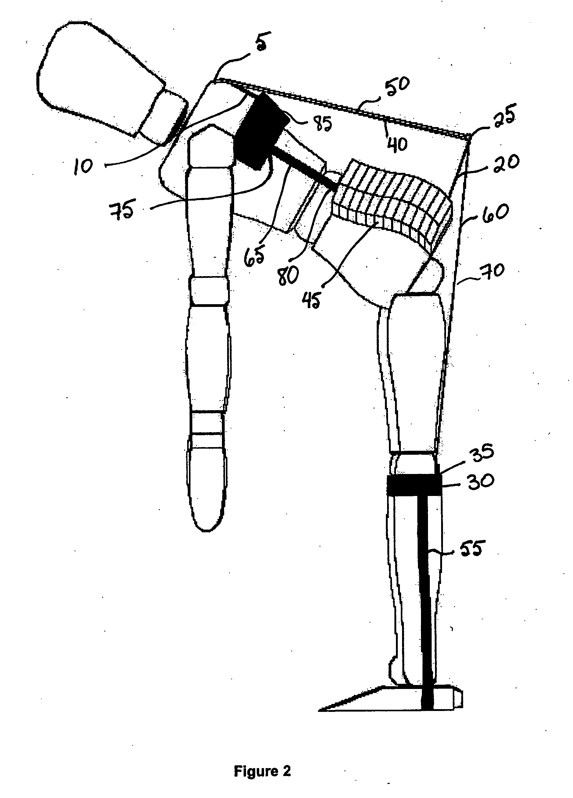 Lift assist device and method
