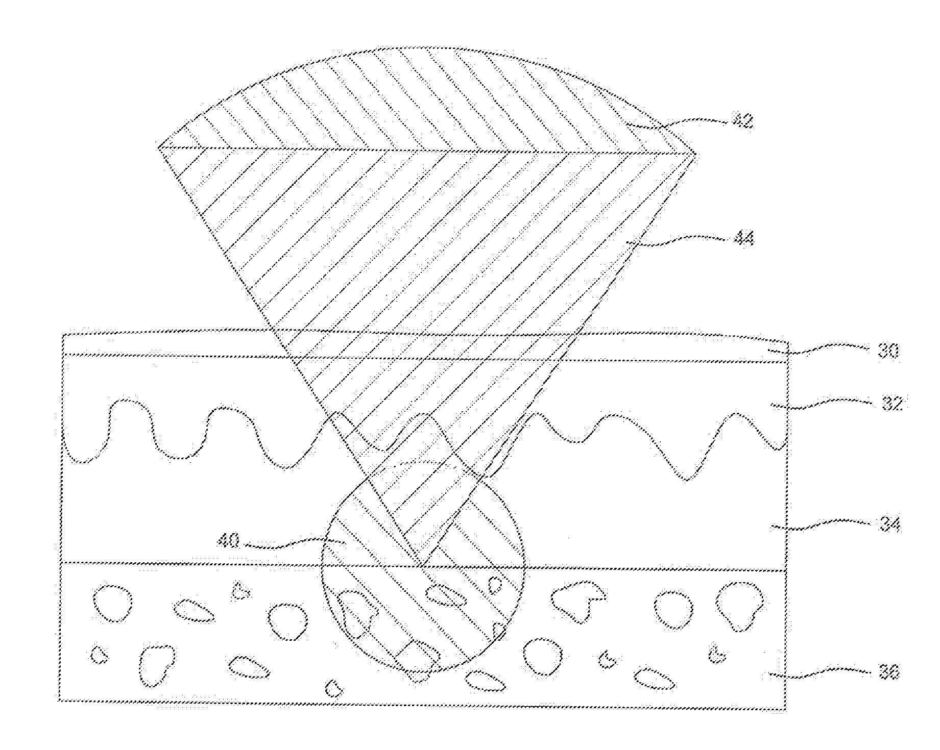 Medical treatment apparatus with laser pulses in the femtosecond range