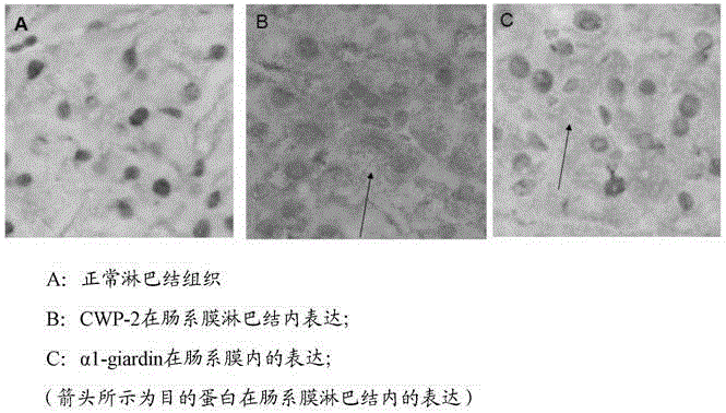 Divalent DNA vaccine for preventing giardiasis and enteric-coated preparation thereof
