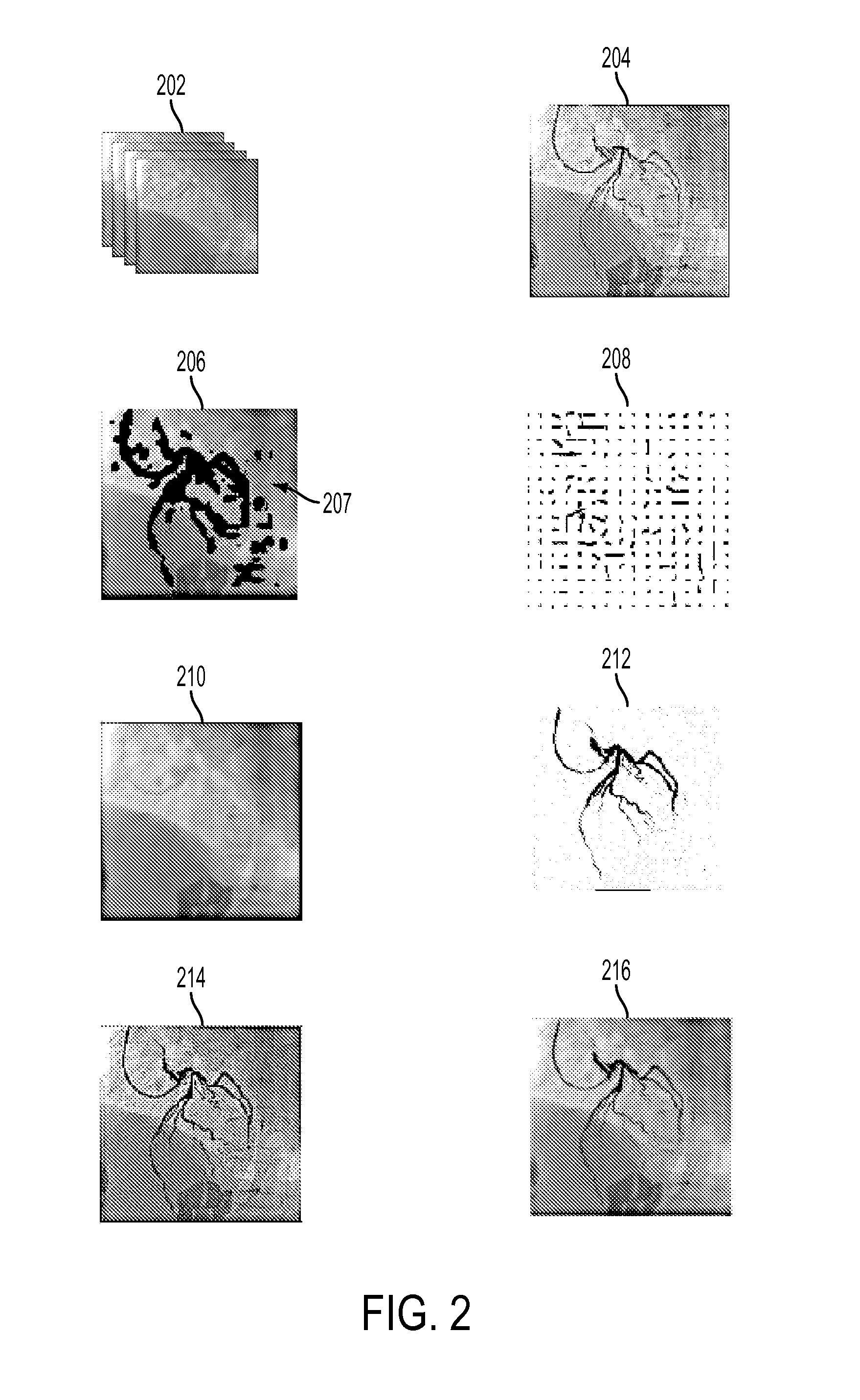 System and Method for Coronary Digital Subtraction Angiography