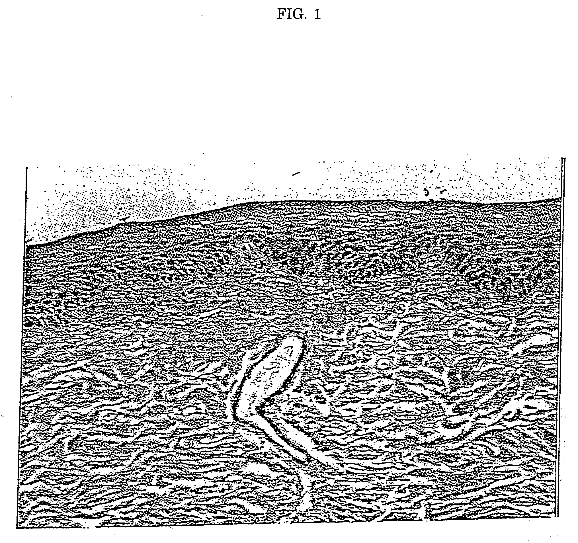 Method for inhibiting bone resorption