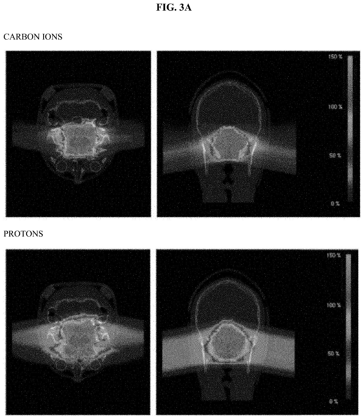 Deuteron therapy