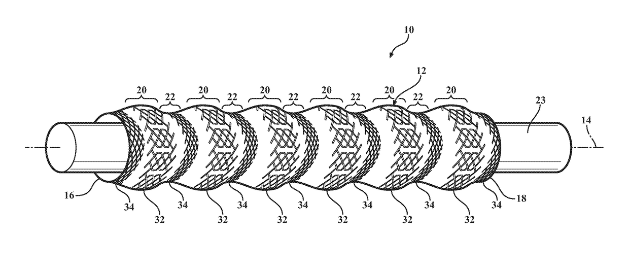 Braided textile sleeve with axially collapsible, Anti-kinking feature and method of construction thereof