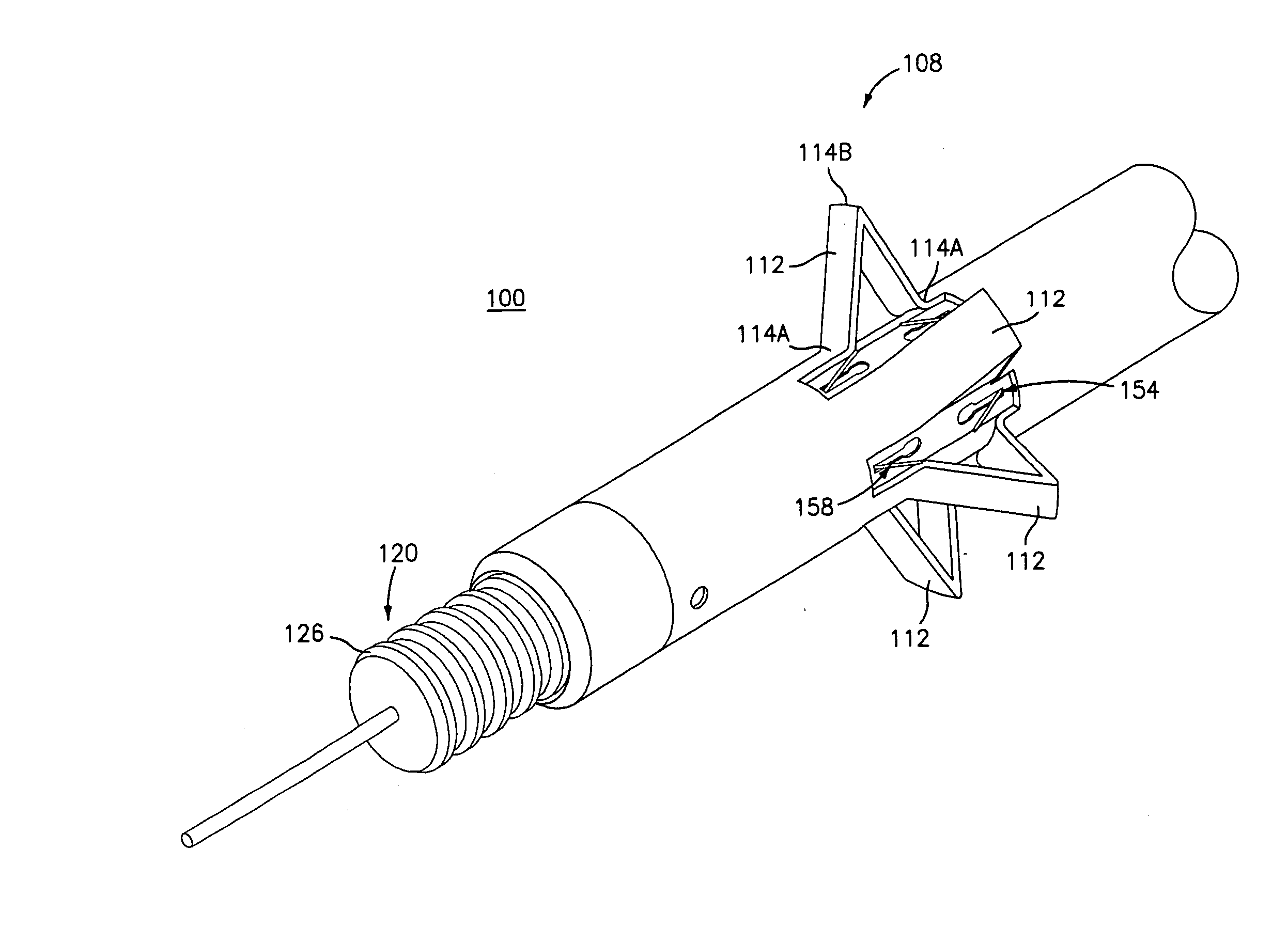 Method and appartus for anastomosis including an anchoring sleeve