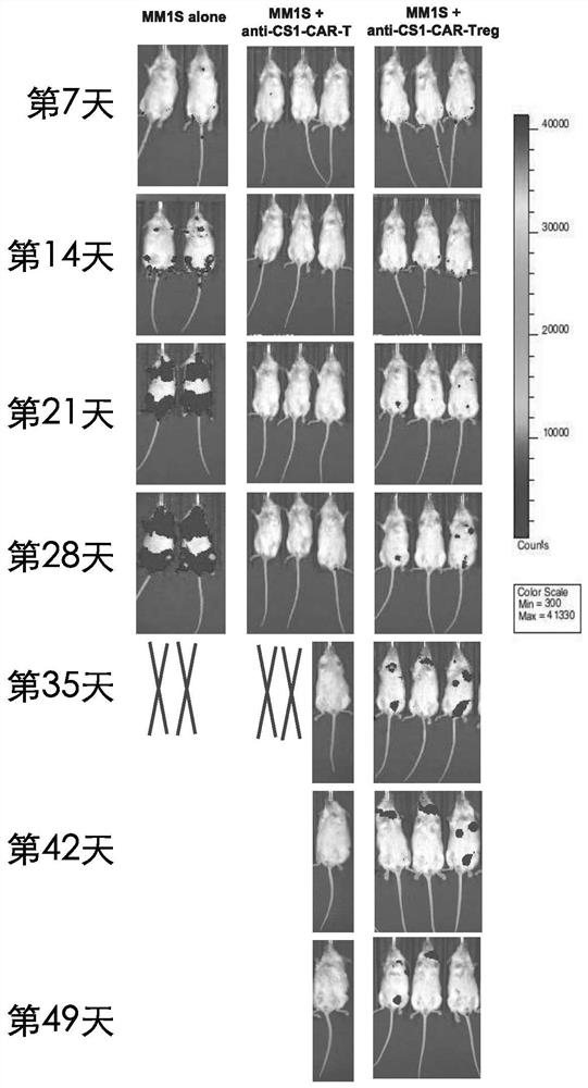 Preparation method and application of universal chimeric antigen receptor regulatory T cell