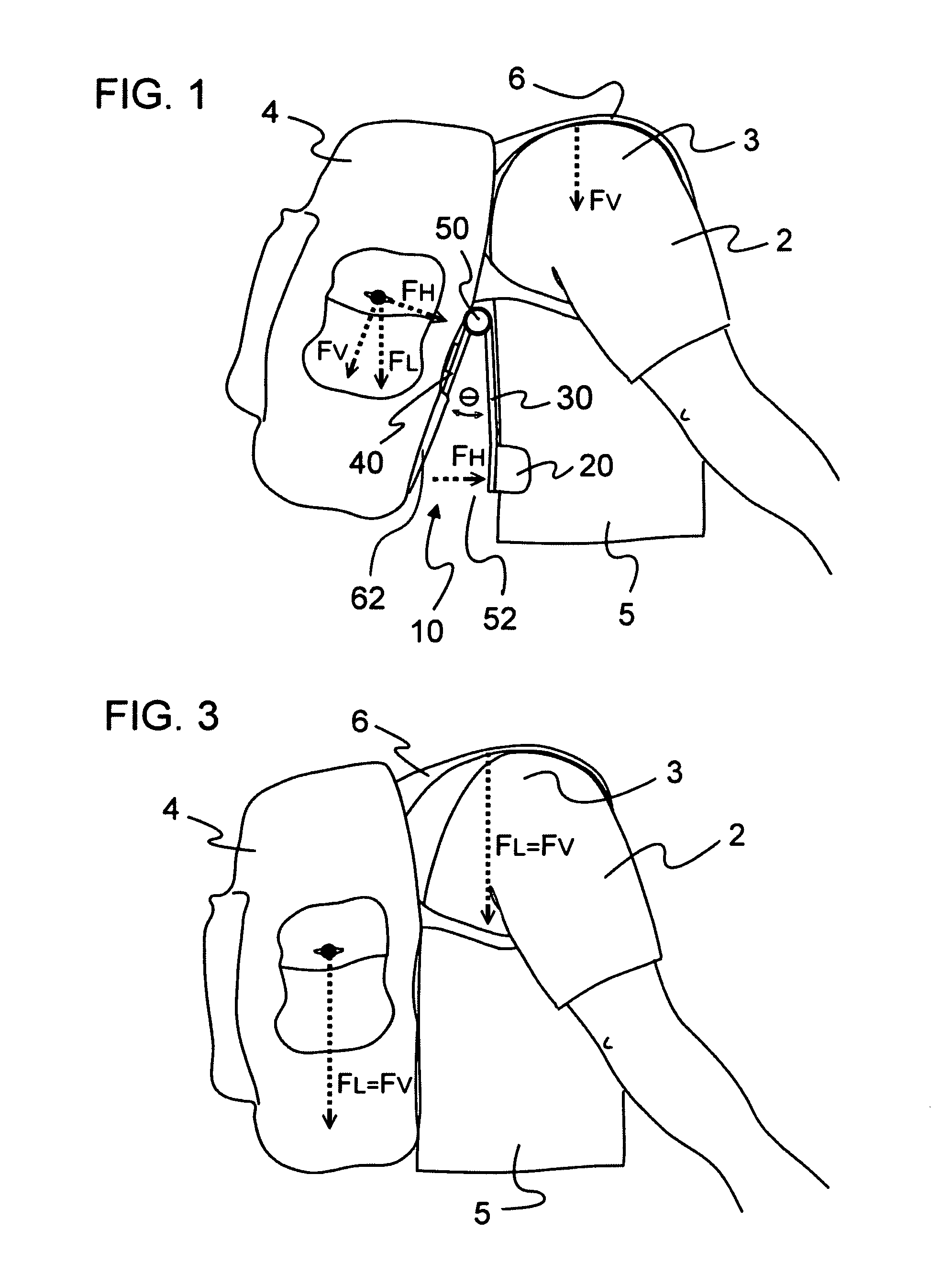 Backpack load carrying system
