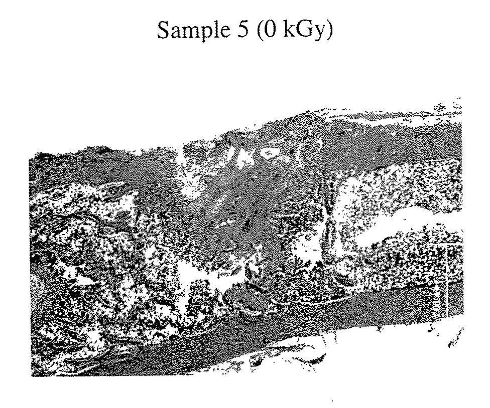 Porous body comprising apatite/collagen composite fibers and its production method