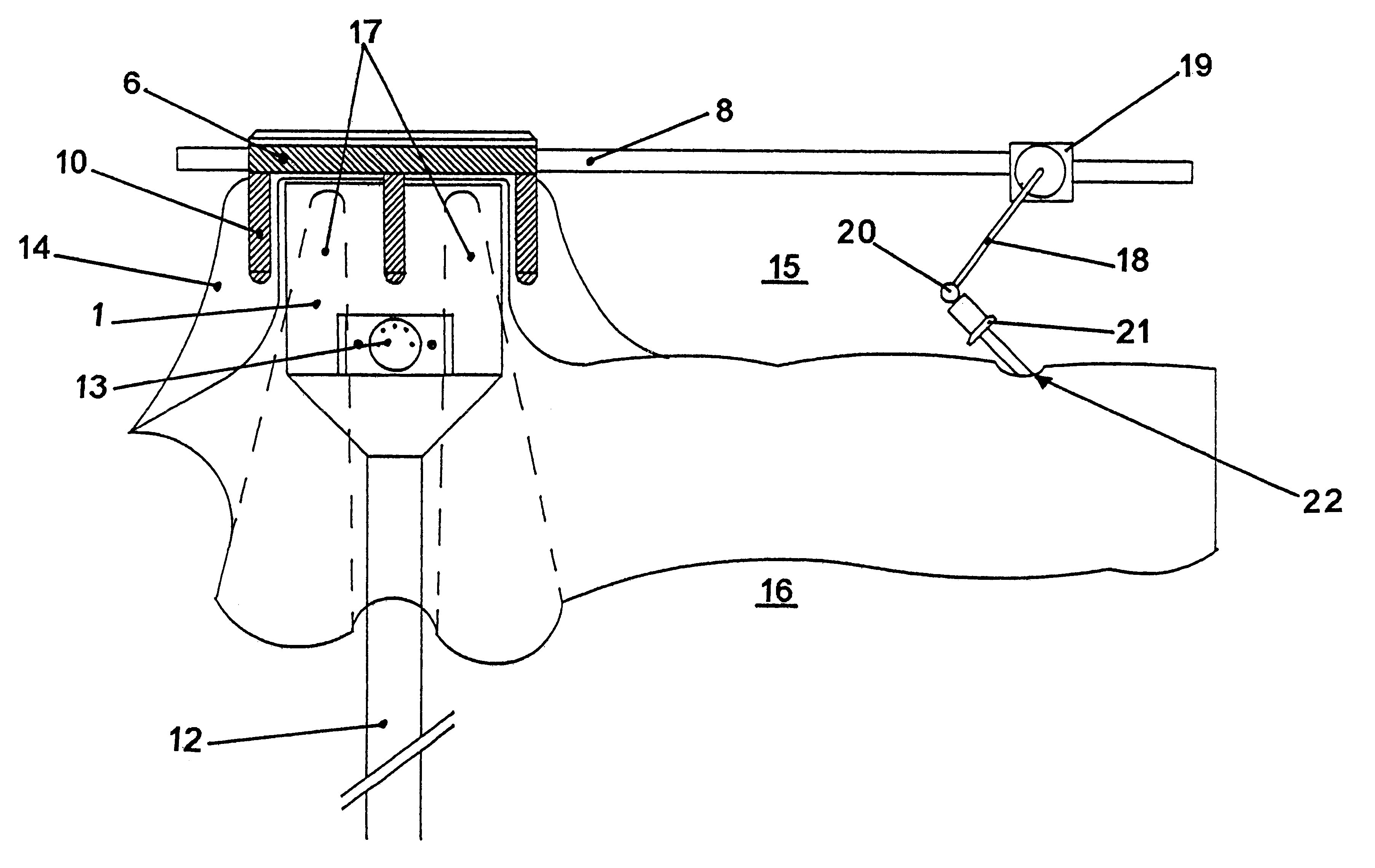 Fixing device for at least one operating element suitable for application in sterile areas in surgical operations, such as a surgical instrument