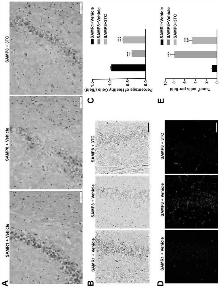 Application of lamivudine in preparation of medicine for treating Alzheimer's disease