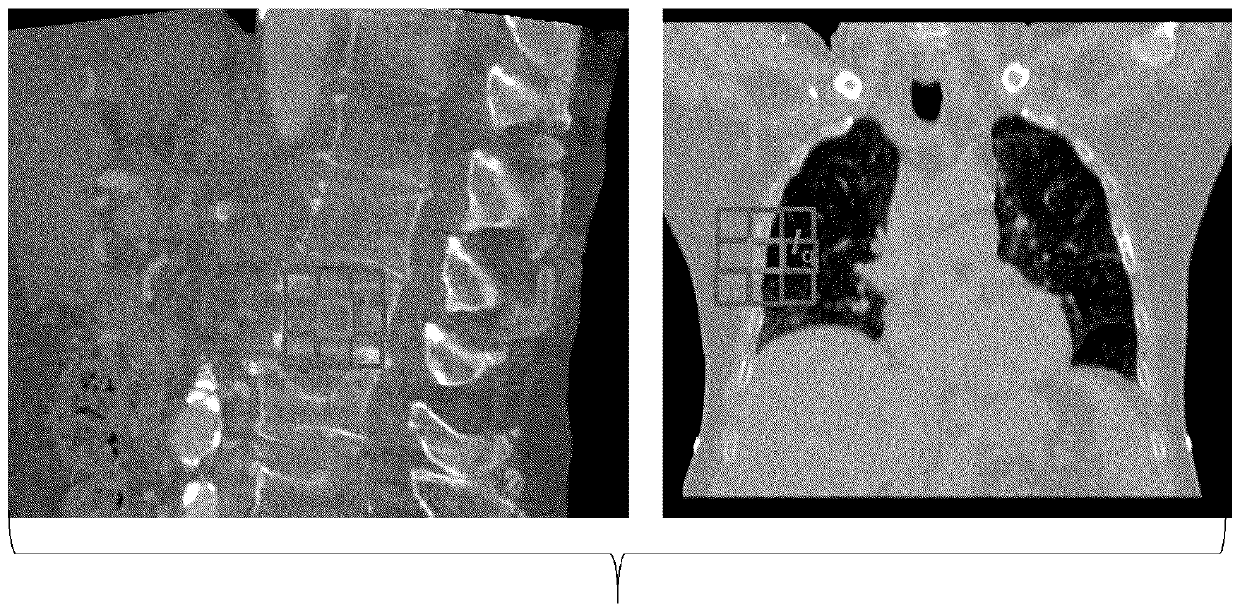Deep-learnt tissue deformation for medical imaging