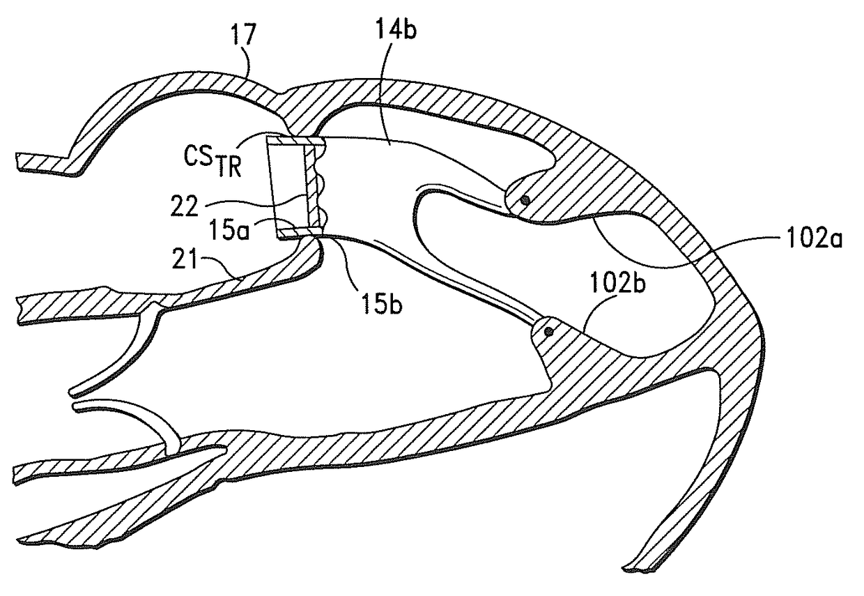 Systems, apparatus and methods for sealing perivalvular leaks