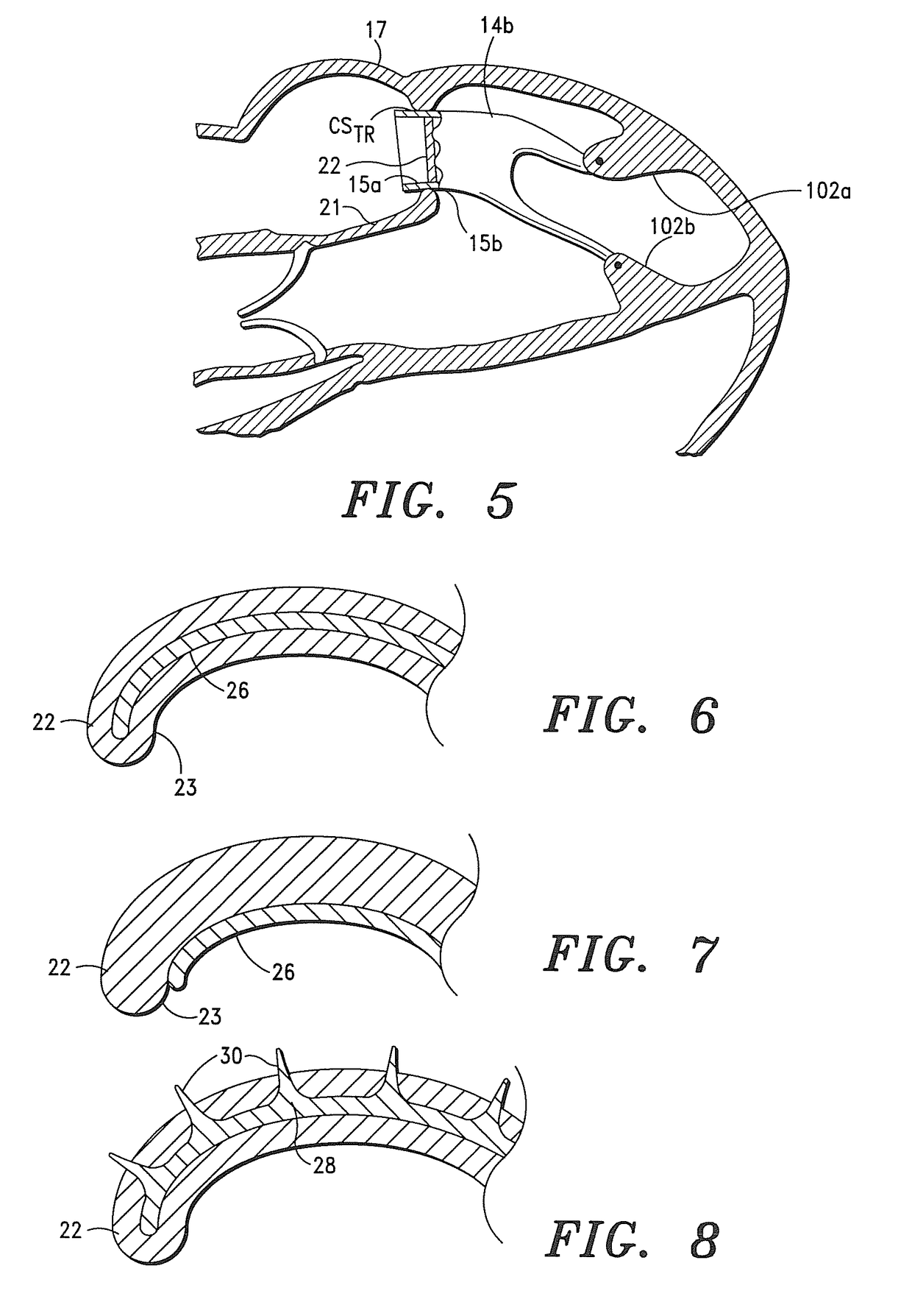 Systems, apparatus and methods for sealing perivalvular leaks