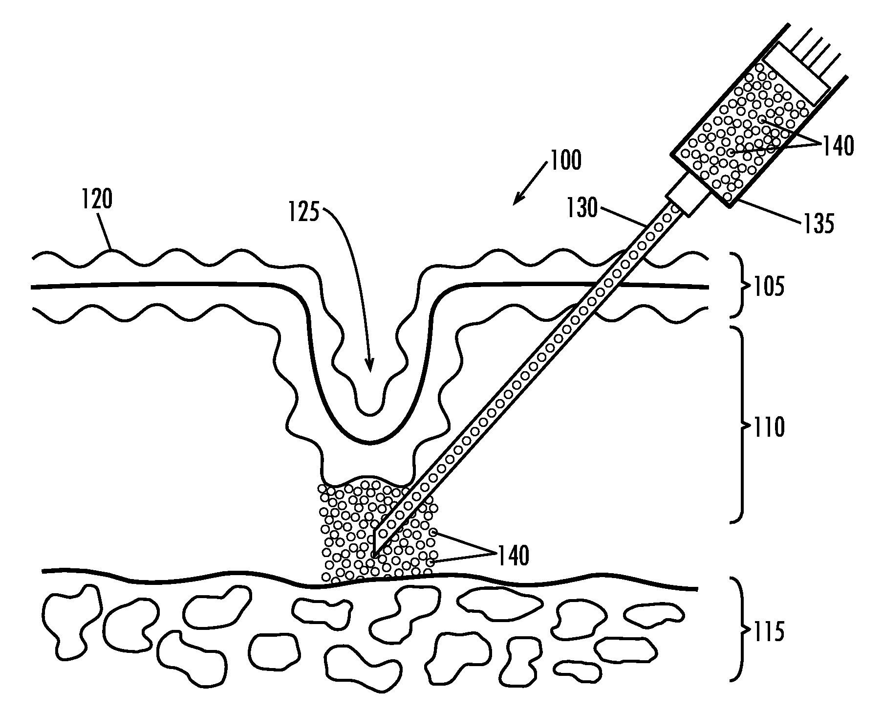 Loadable Polymeric Particles for Cosmetic and Reconstructive Tissue Augmentation Applications and Methods of Preparing and Using the Same