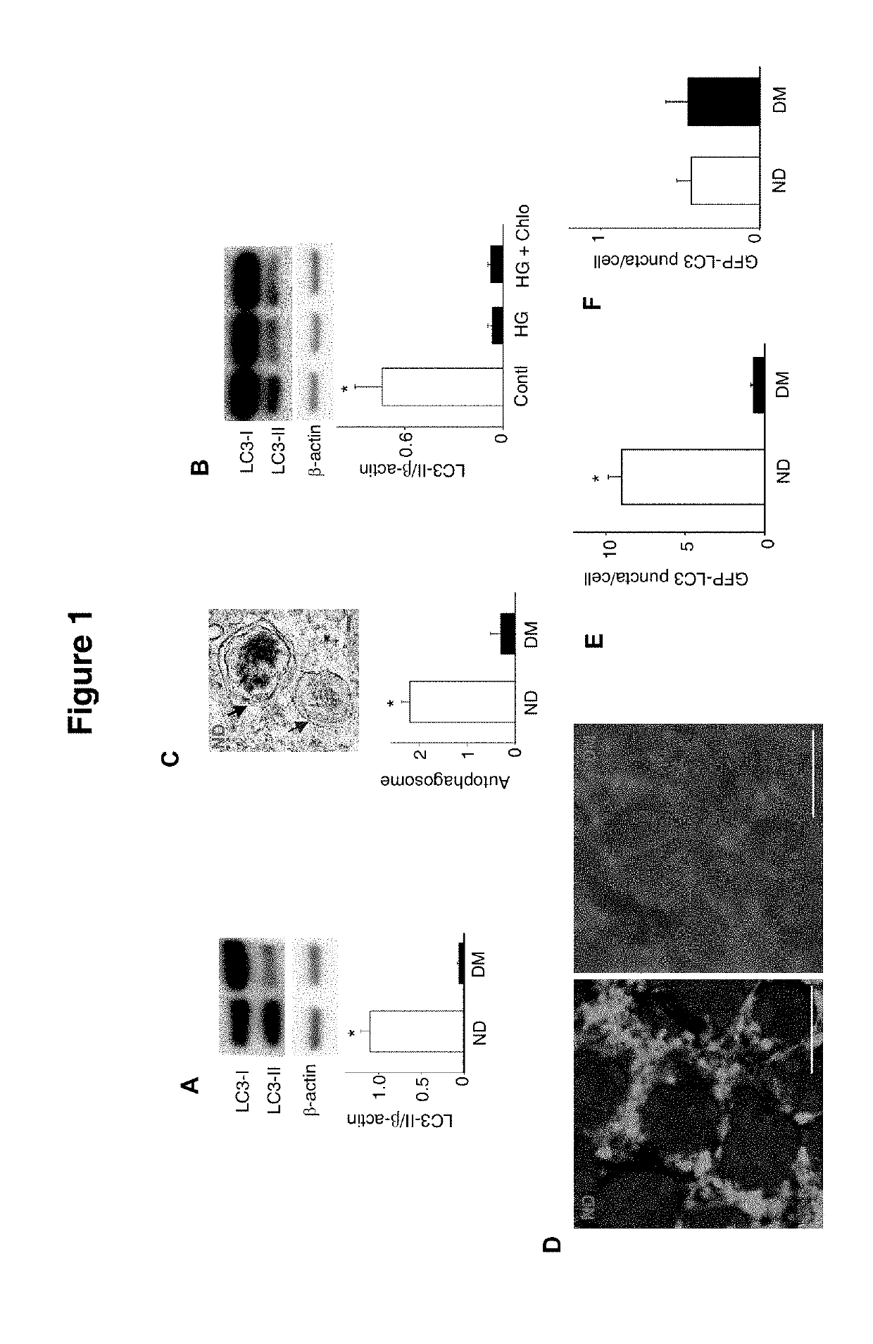 Use of trehalose for prevention of neural tube defects