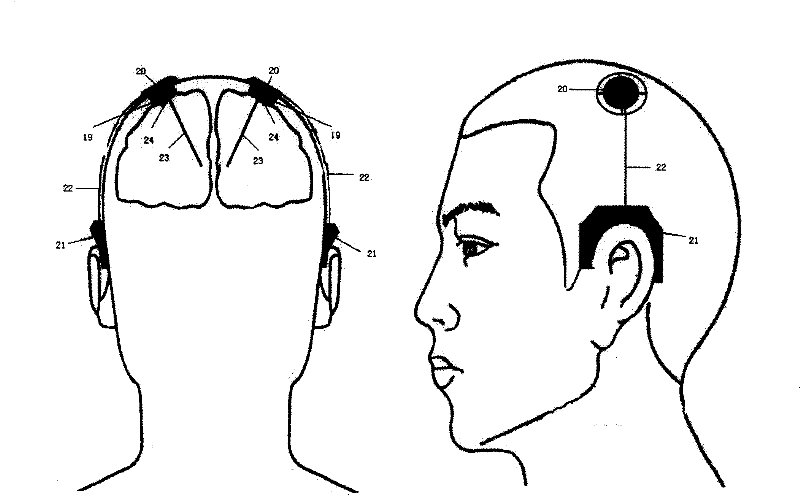 Intelligent cranial nuclei electric stimulation system