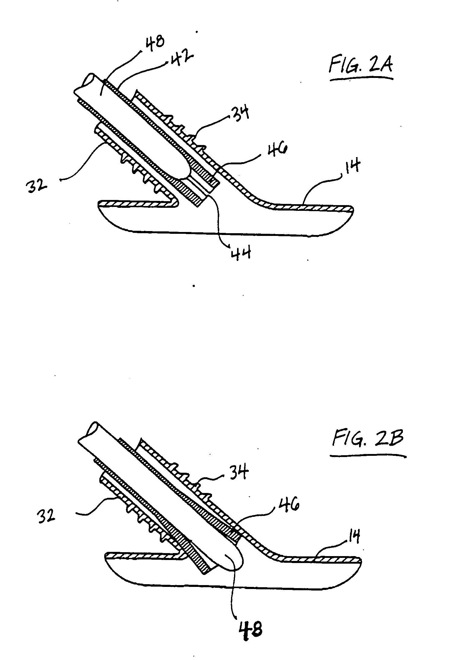 Methods and devices for placing a conduit in fluid communication with a target vessel and a source of blood
