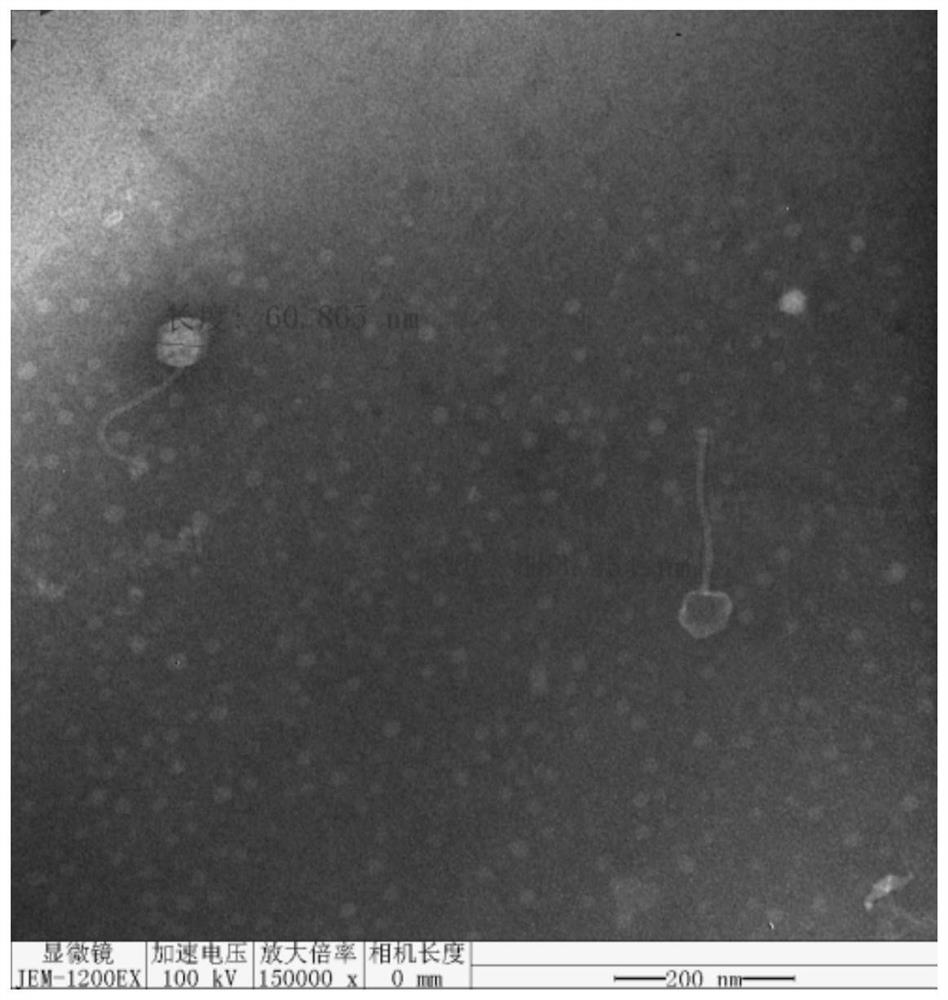 A highly lytic Pseudomonas aeruginosa phage rdp-pa-20001 and its application