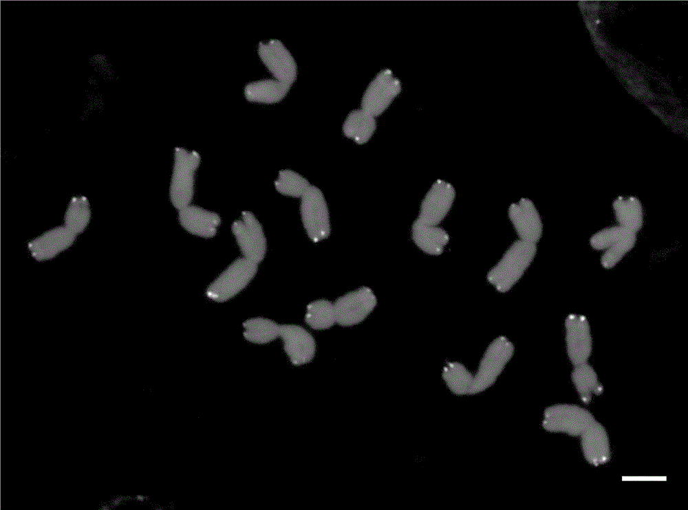 Wheat root tip chromosome production method