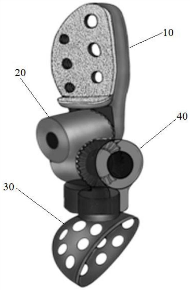 Three-joint artificial pelvic prosthesis fixed through lumbosacral vertebrae