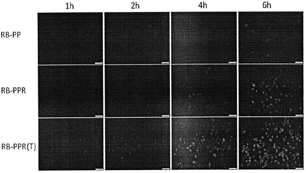 Targeting posterior segment eye drug delivery system, preparation thereof and preparation method of preparation
