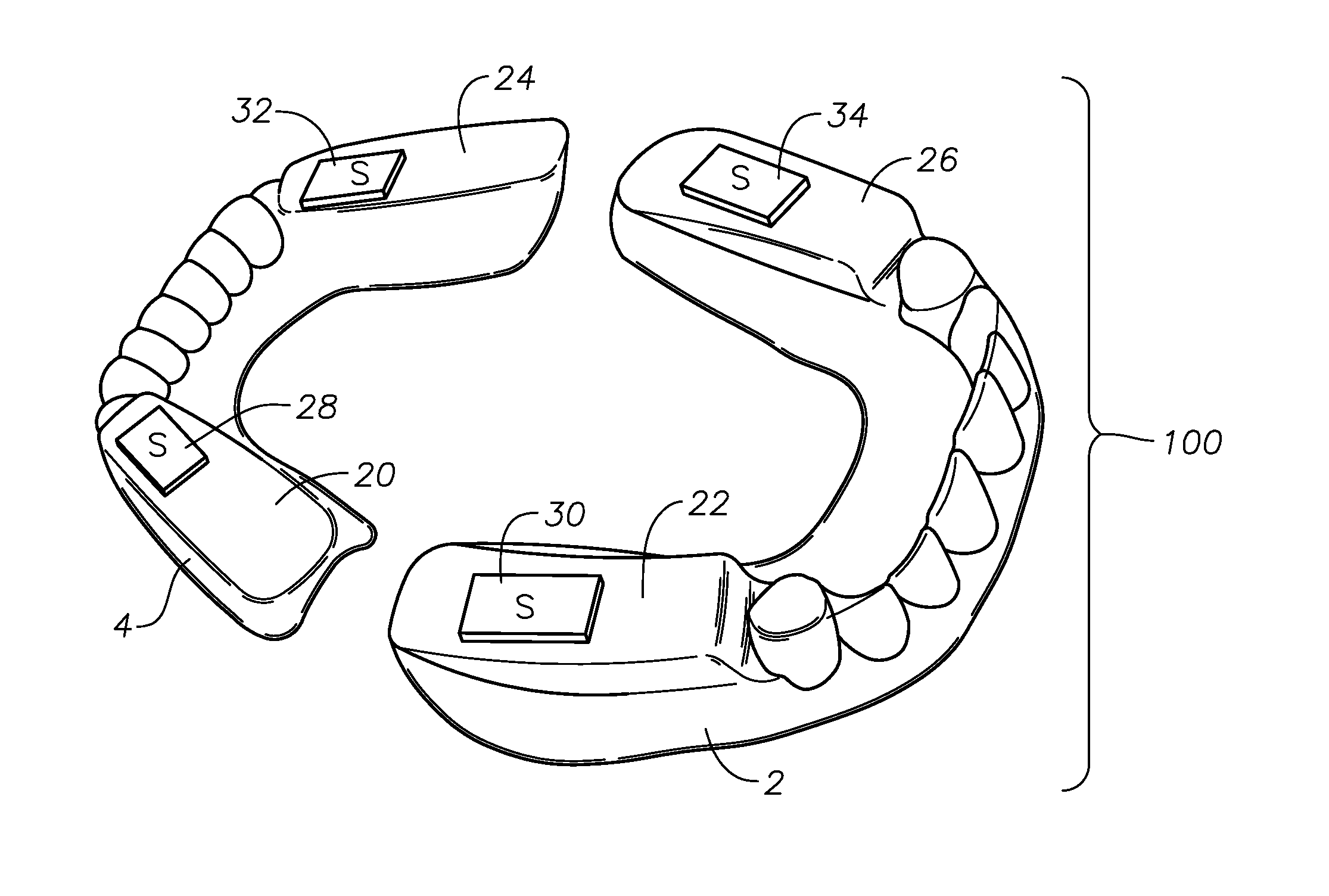 Oral devices, kits, and methods for reducing sleep apnea, snoring, and/or nasal drainage