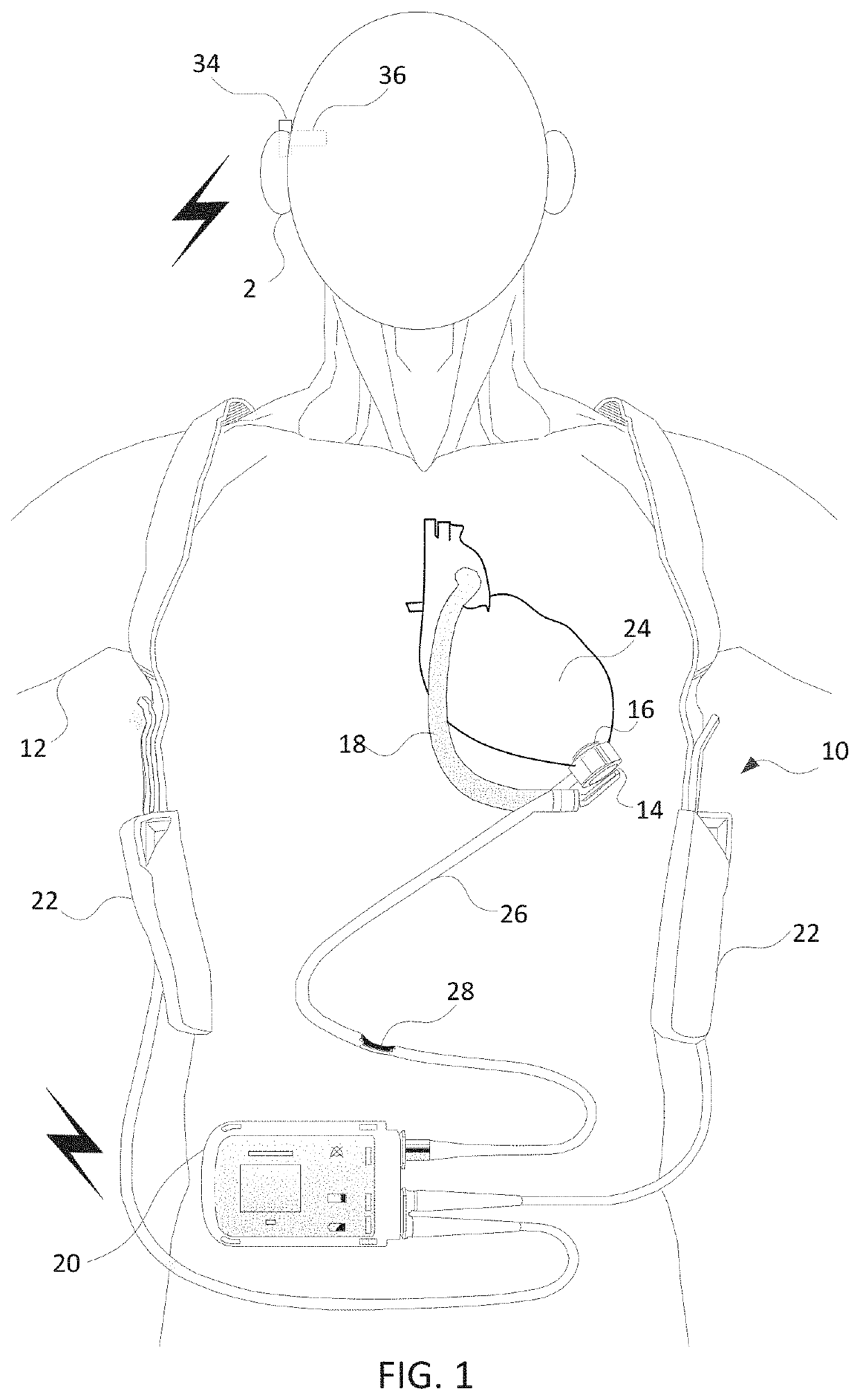 Methods and systems for bone conduction audible alarms for mechanical circulatory support systems