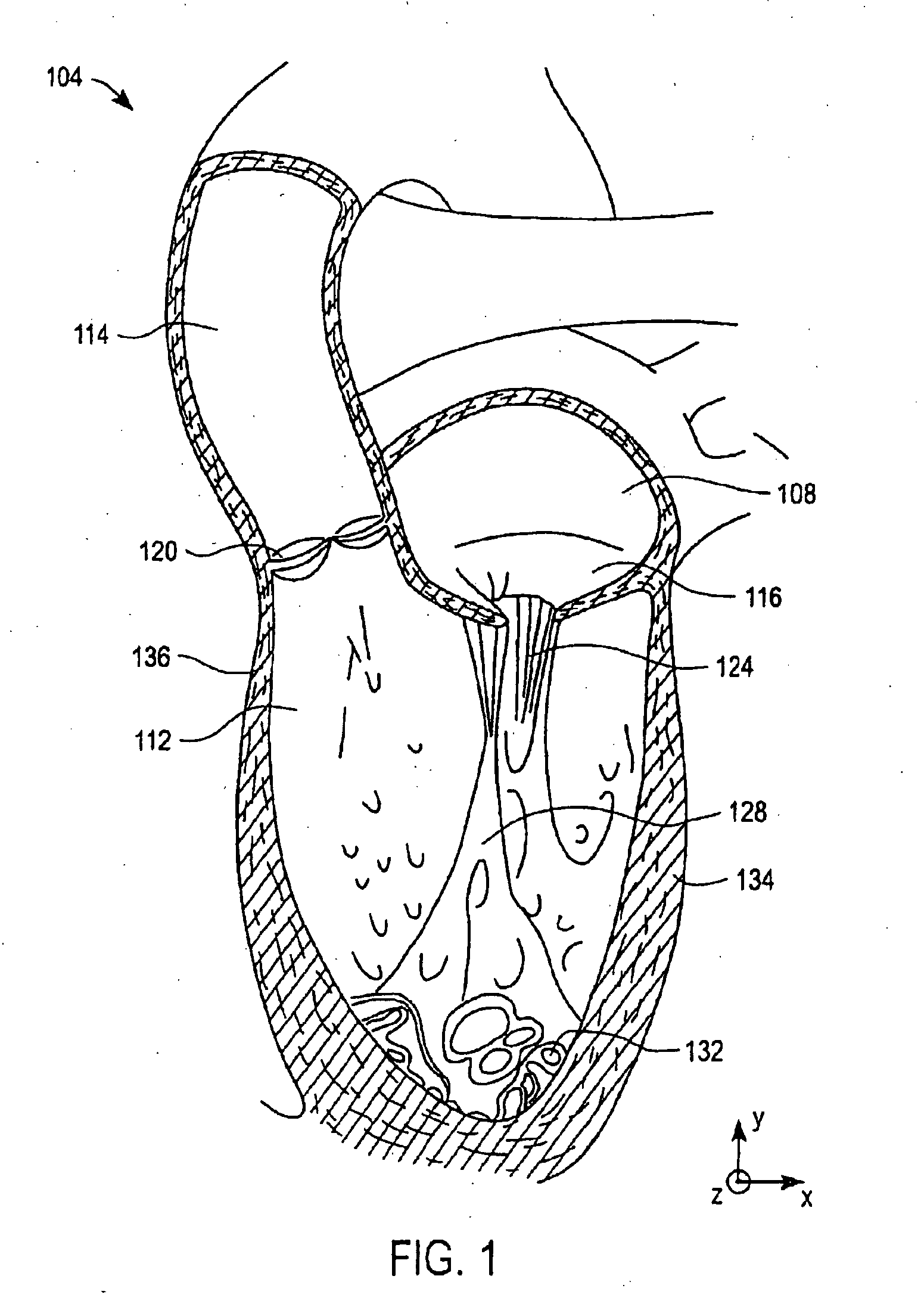 Methods and devices for modulation of heart valve function
