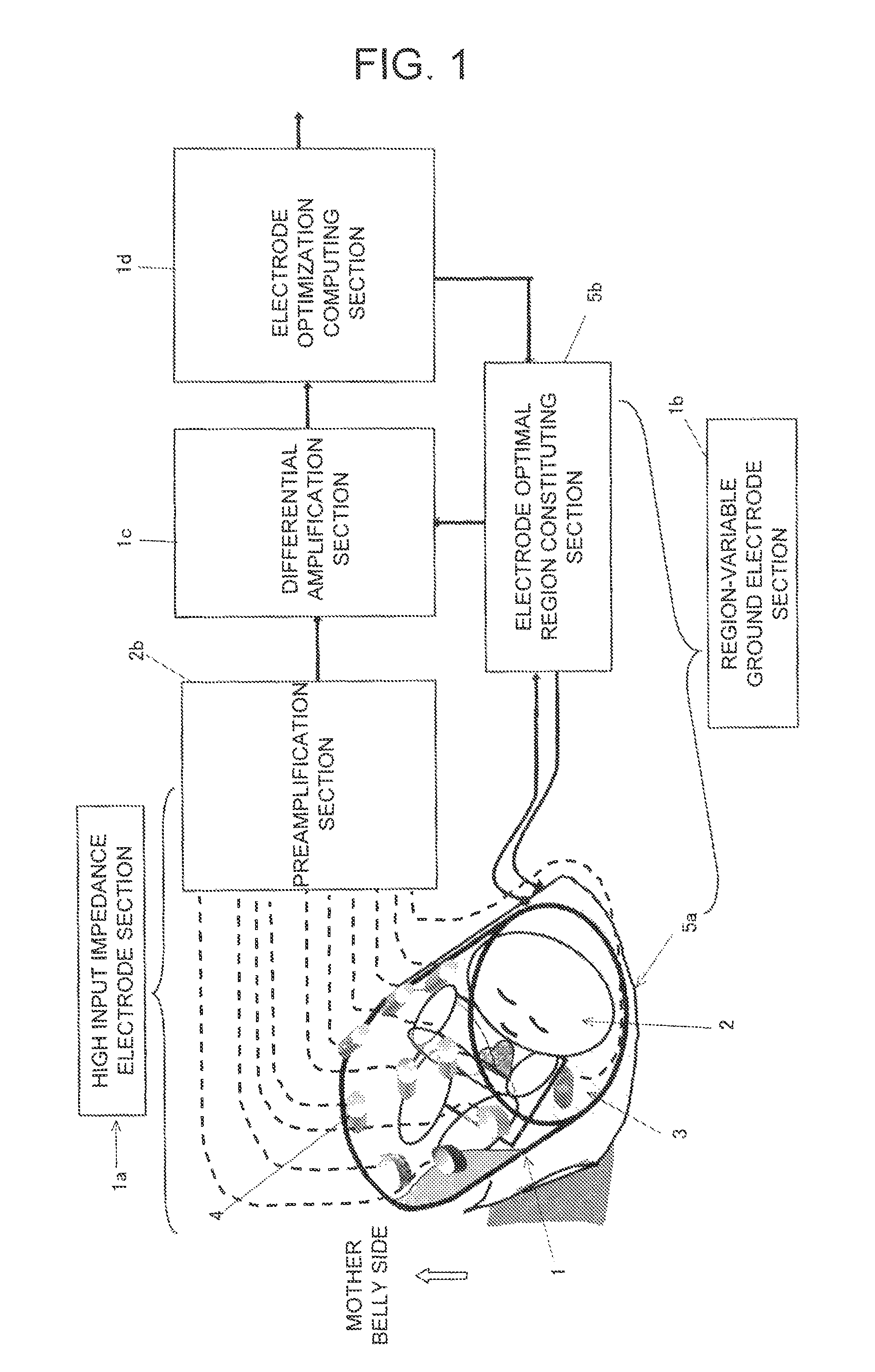 Fetus electrocardiogram signal measuring method and its device
