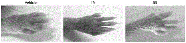 Application of eleutheroside e in preparation of medicine for treating rheumatoid arthritis