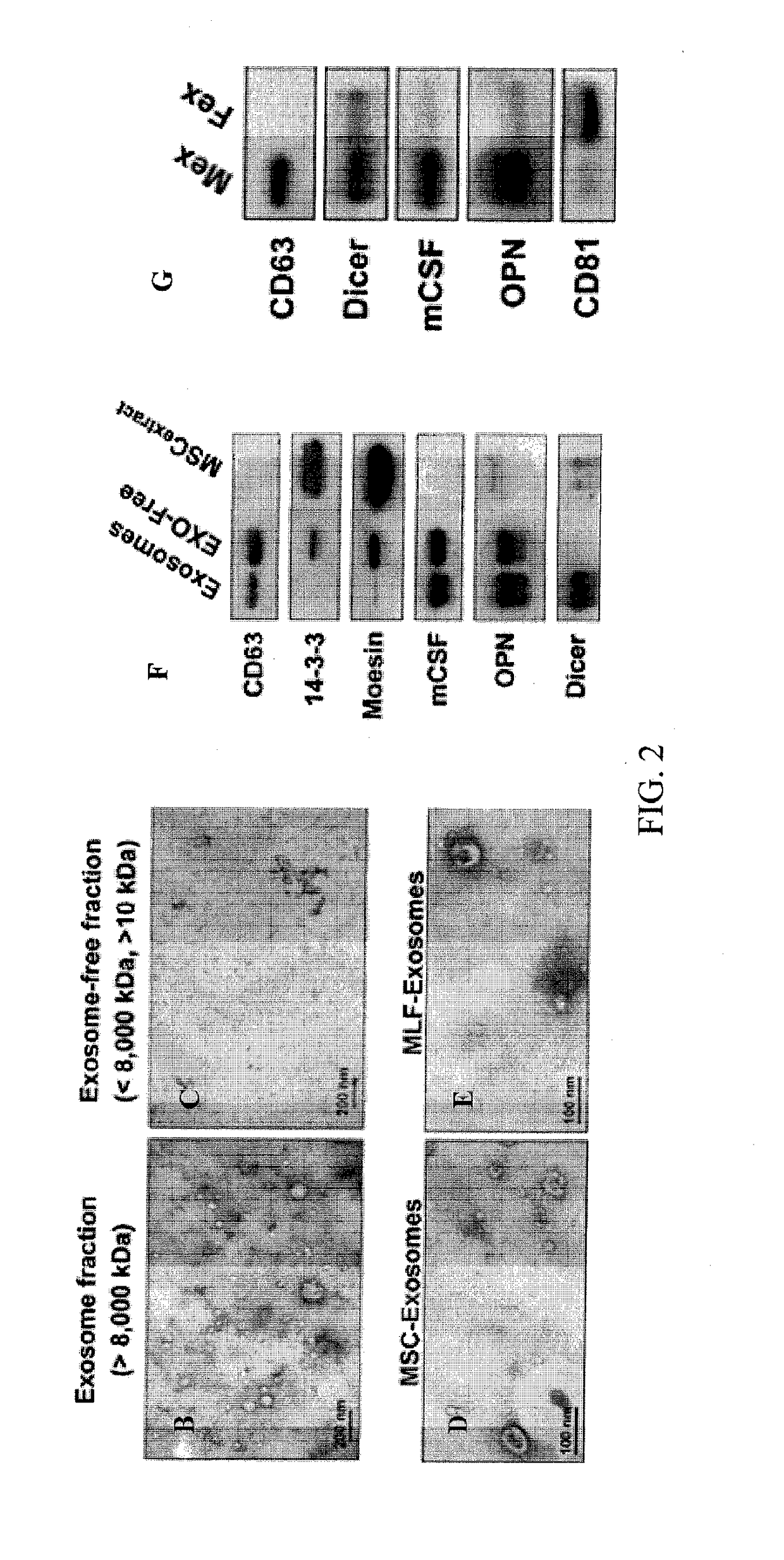 Methods and compositions relating to mesenchymal stem cell exosomes