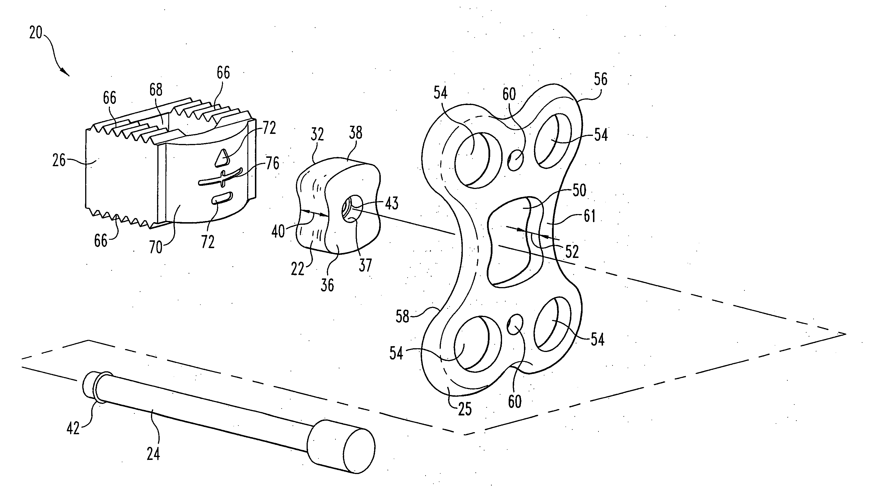 Orthopedic support locating or centering feature and method