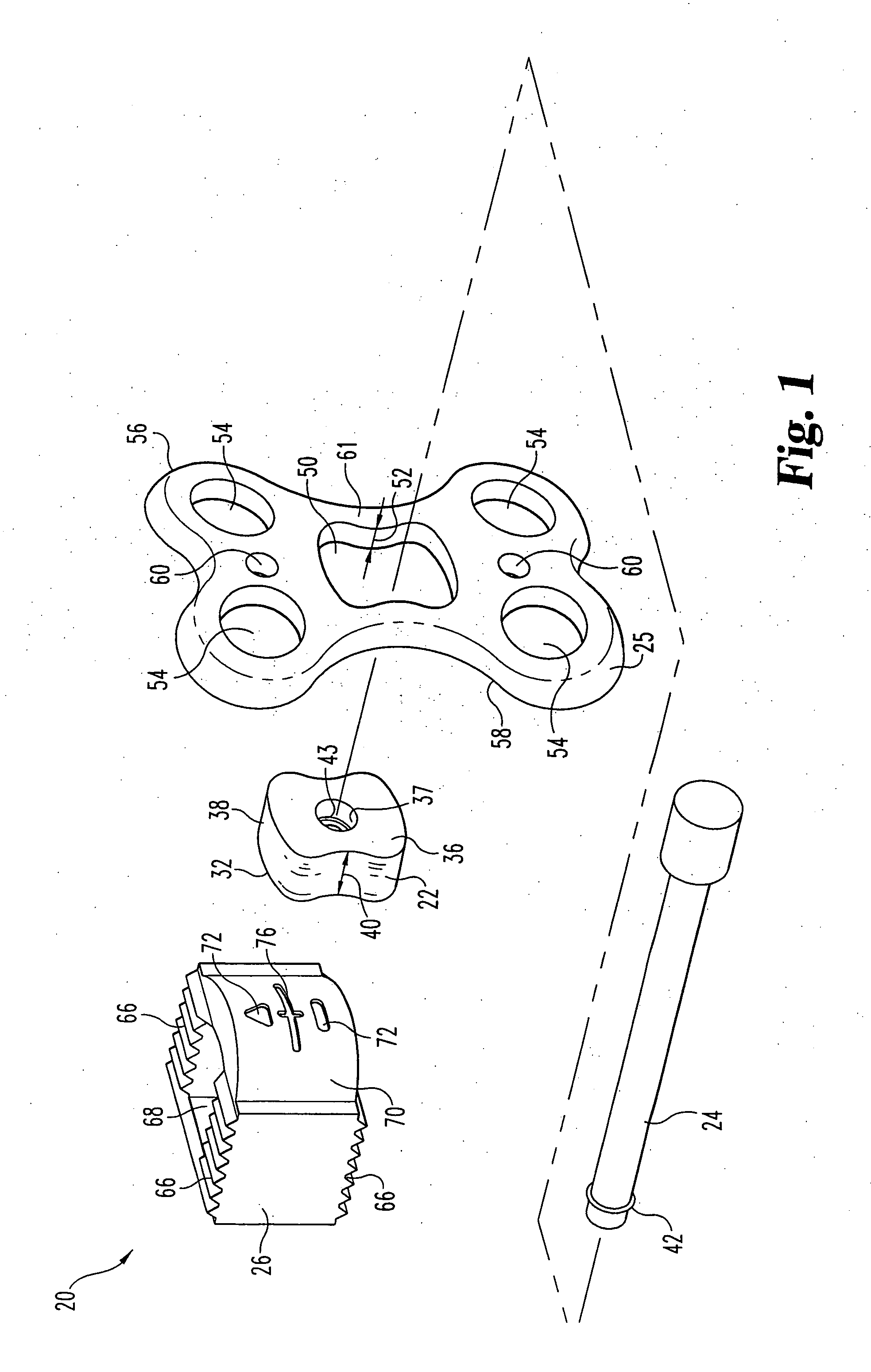 Orthopedic support locating or centering feature and method