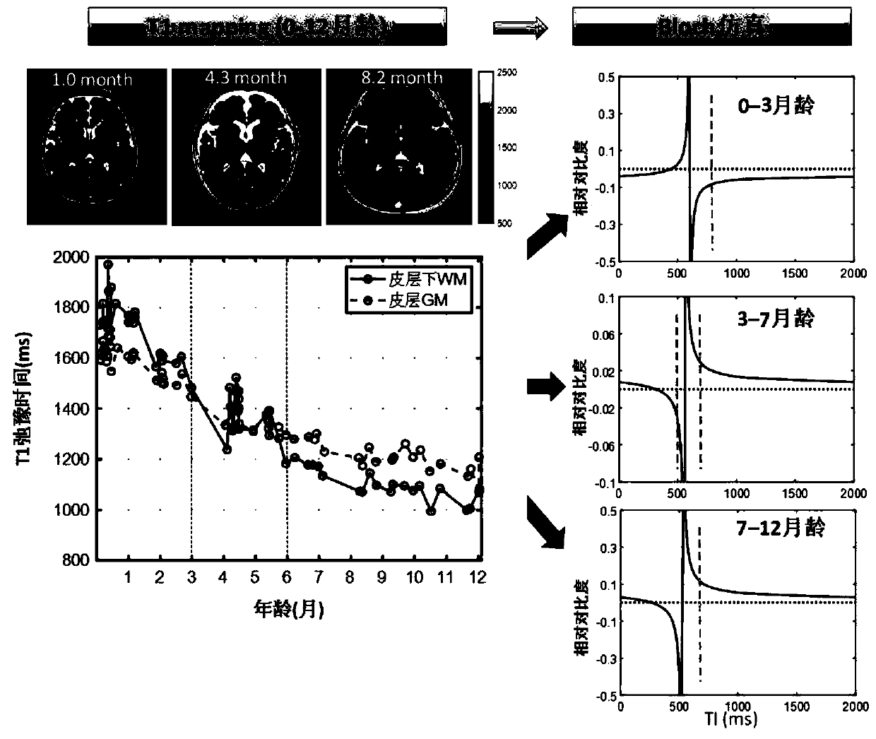 Method for optimizing infant brain T1 weighted magnetic resonance imaging