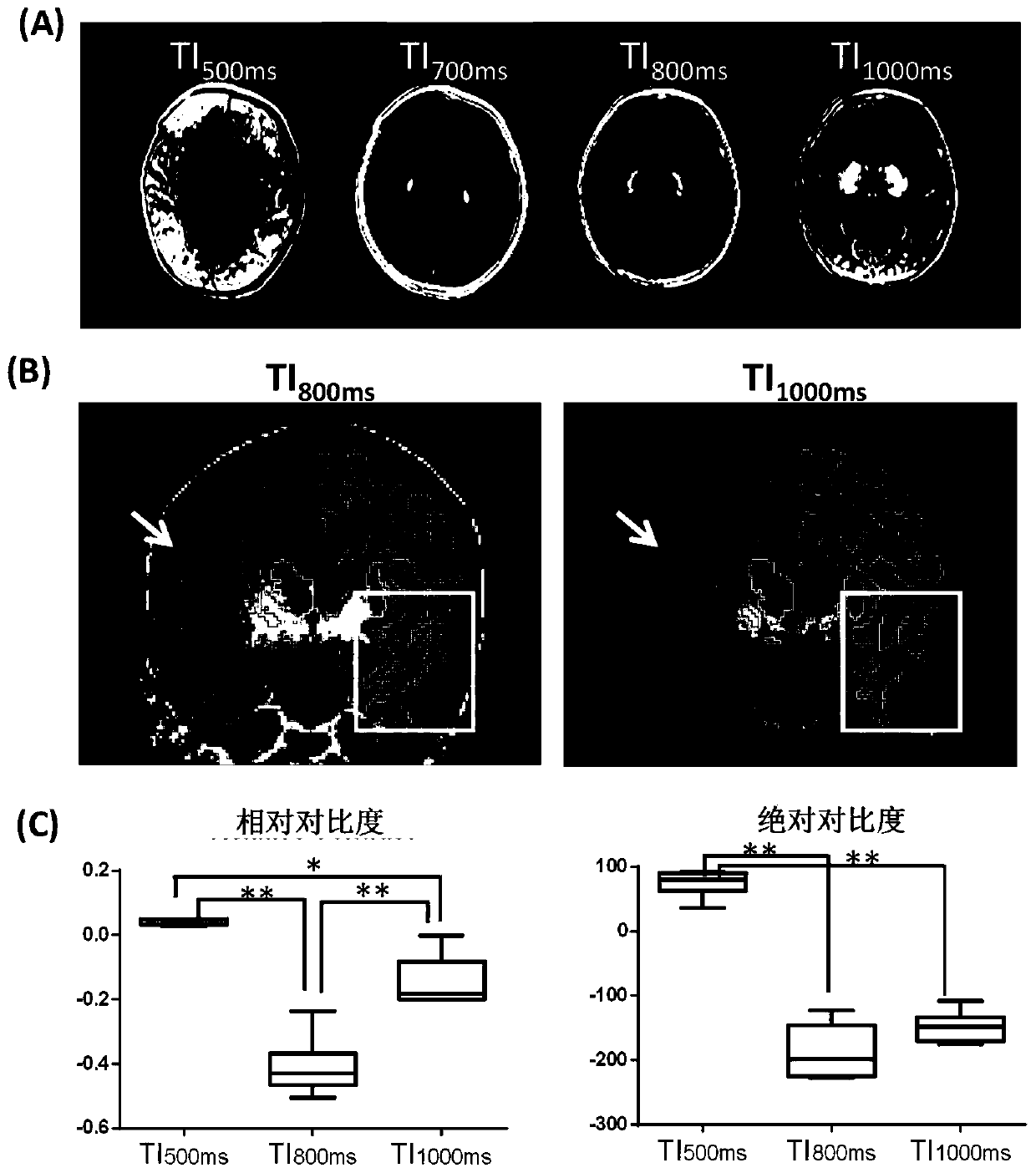 Method for optimizing infant brain T1 weighted magnetic resonance imaging