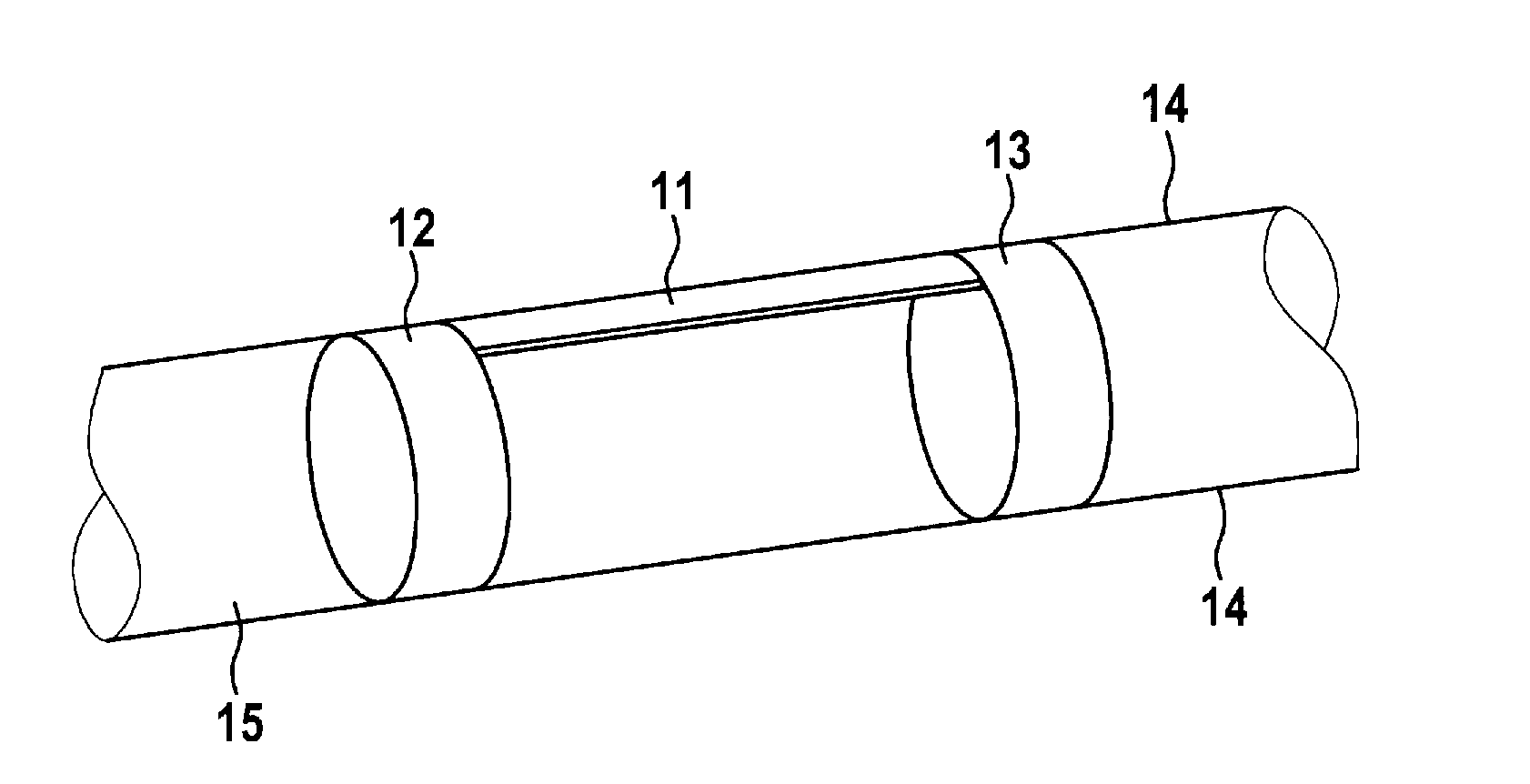 Intravascular Measurement