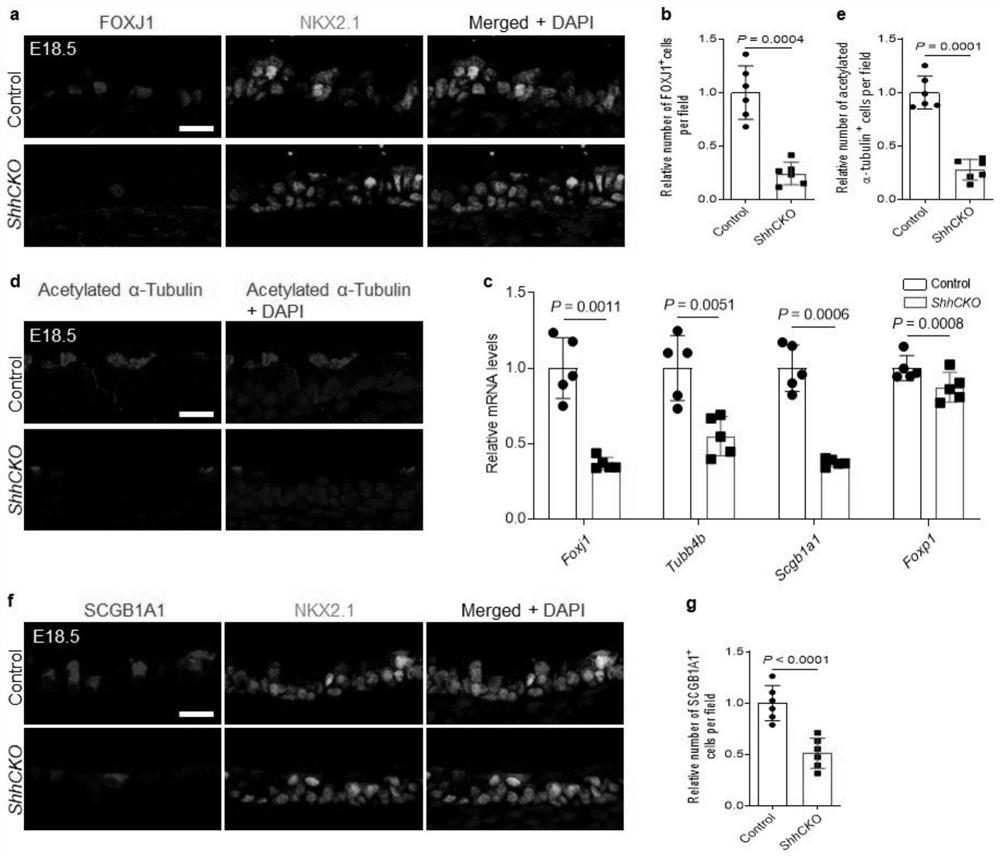 Application of Hedgehog signal channel gene and regulator in regulating physiological functions of airway epithelial cells