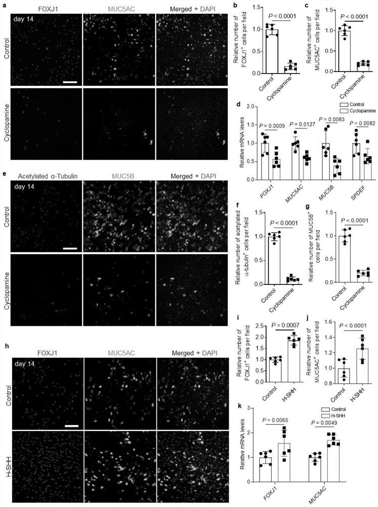 Application of Hedgehog signal channel gene and regulator in regulating physiological functions of airway epithelial cells
