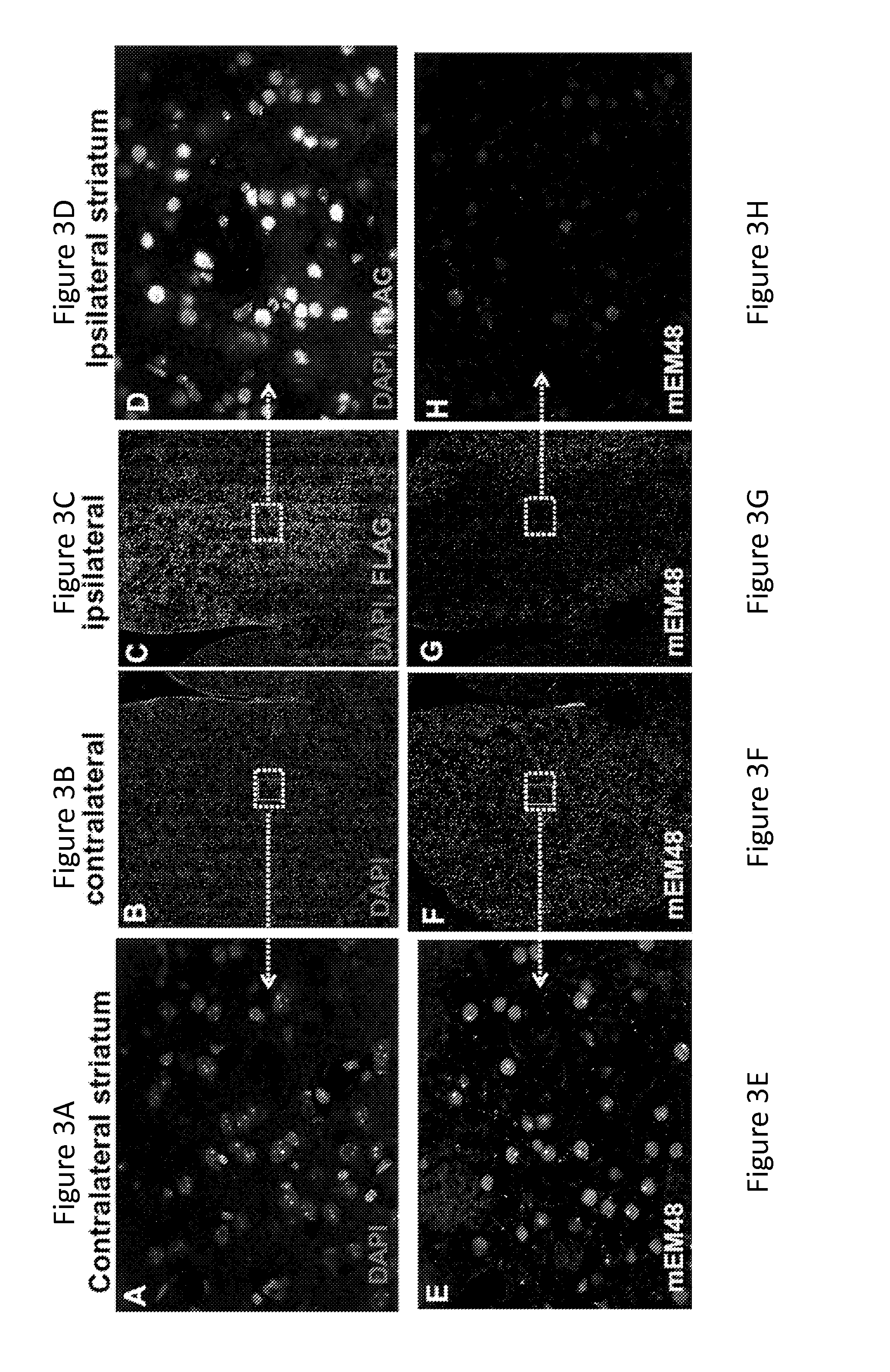 Methods and compositions for treating huntington's disease