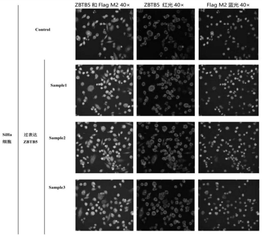 Application of ZBTB5 gene to detection and treatment of drug resistance of paclitaxel for cervical cancer