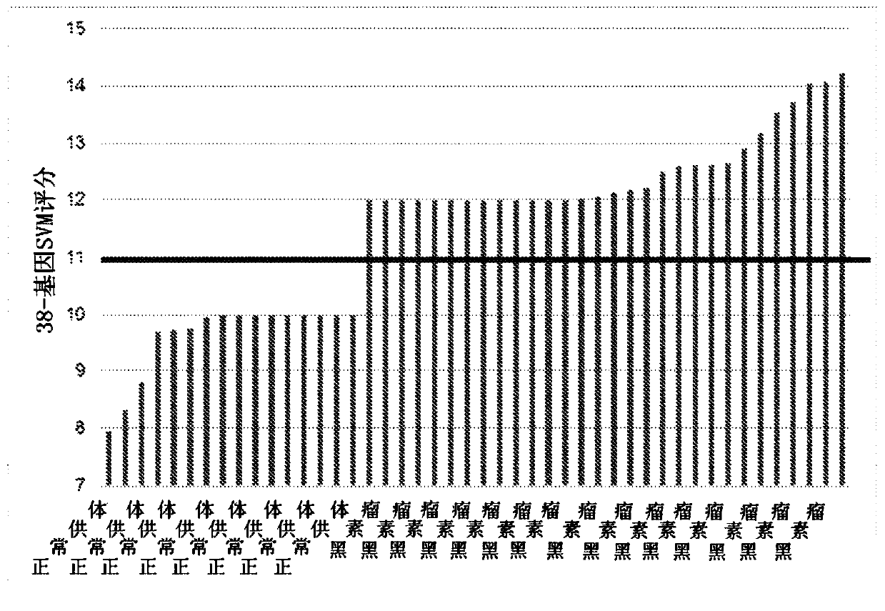 Method of diagnosis, staging and monitoring of melanoma using microrna gene expression