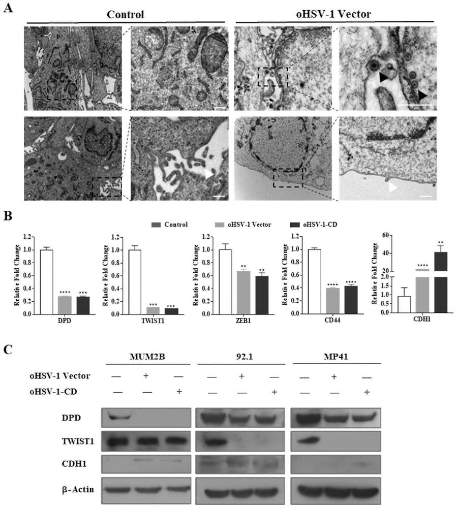 Application of oncolytic virus in treatment on uveal melanoma, marker of treatment effect and detection reagent thereof