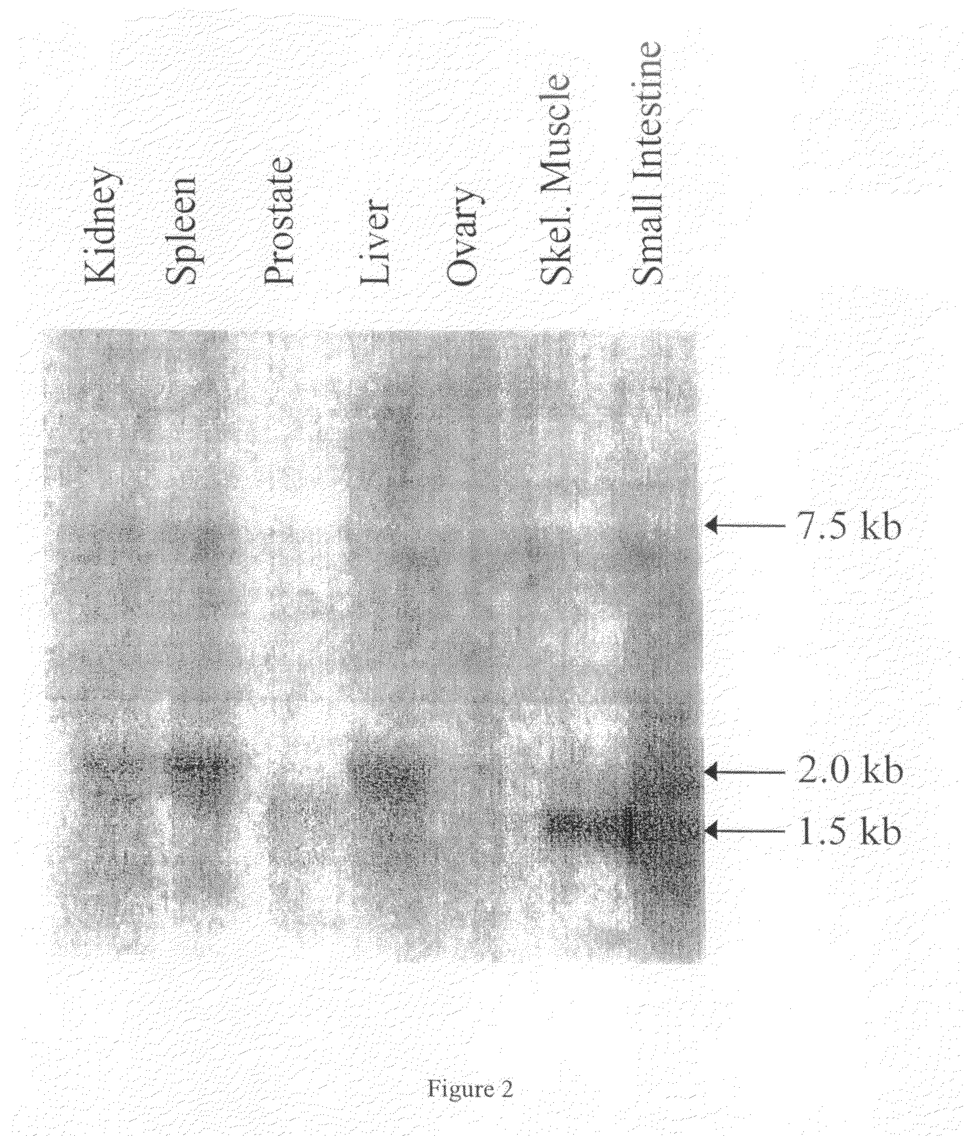 Vascular endothelial cell growth inhibitor, VEGI-192a