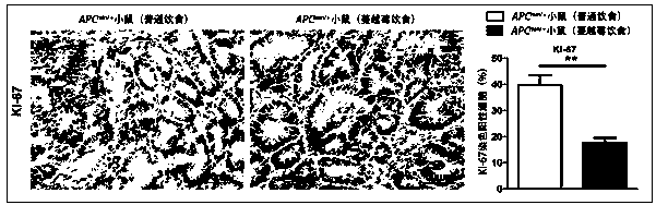 Application of cranberry freeze-dried powder in the preparation of drugs for the prevention and treatment of familial adenomatous polyposis